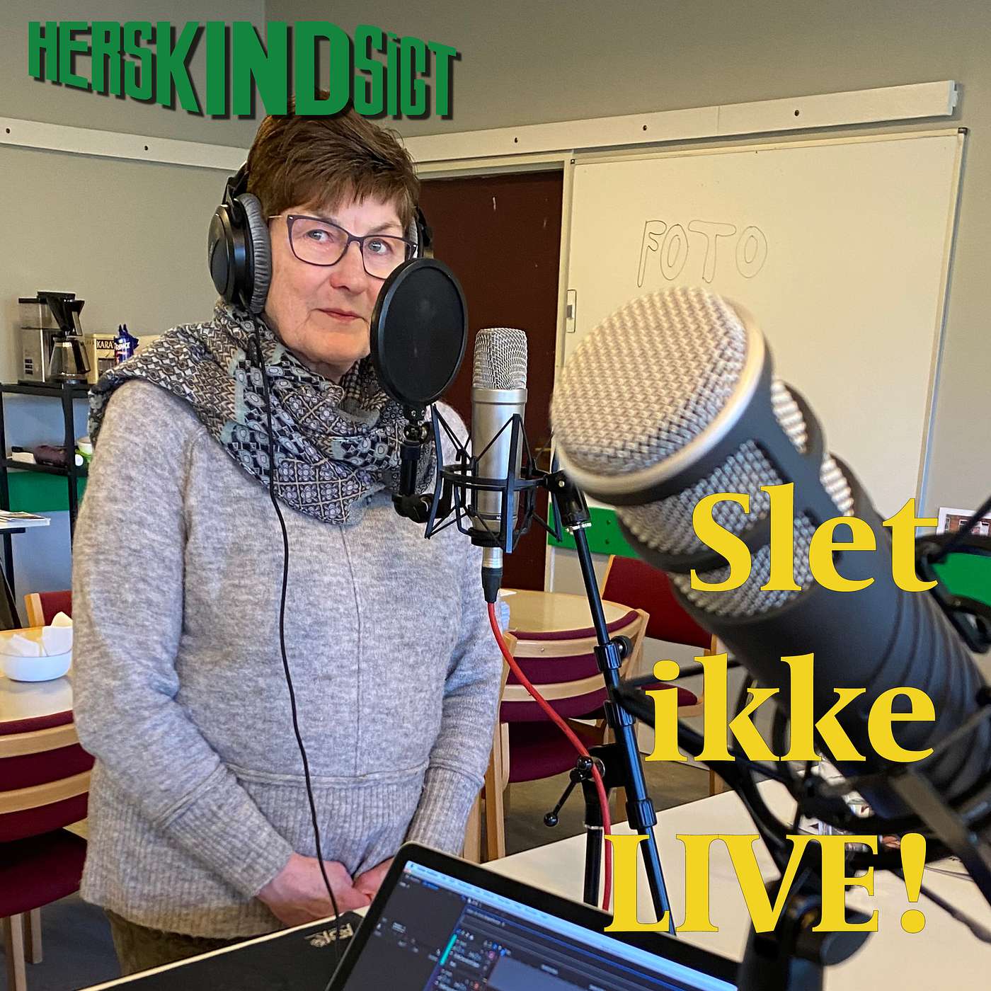 Slet ikke LIVE!