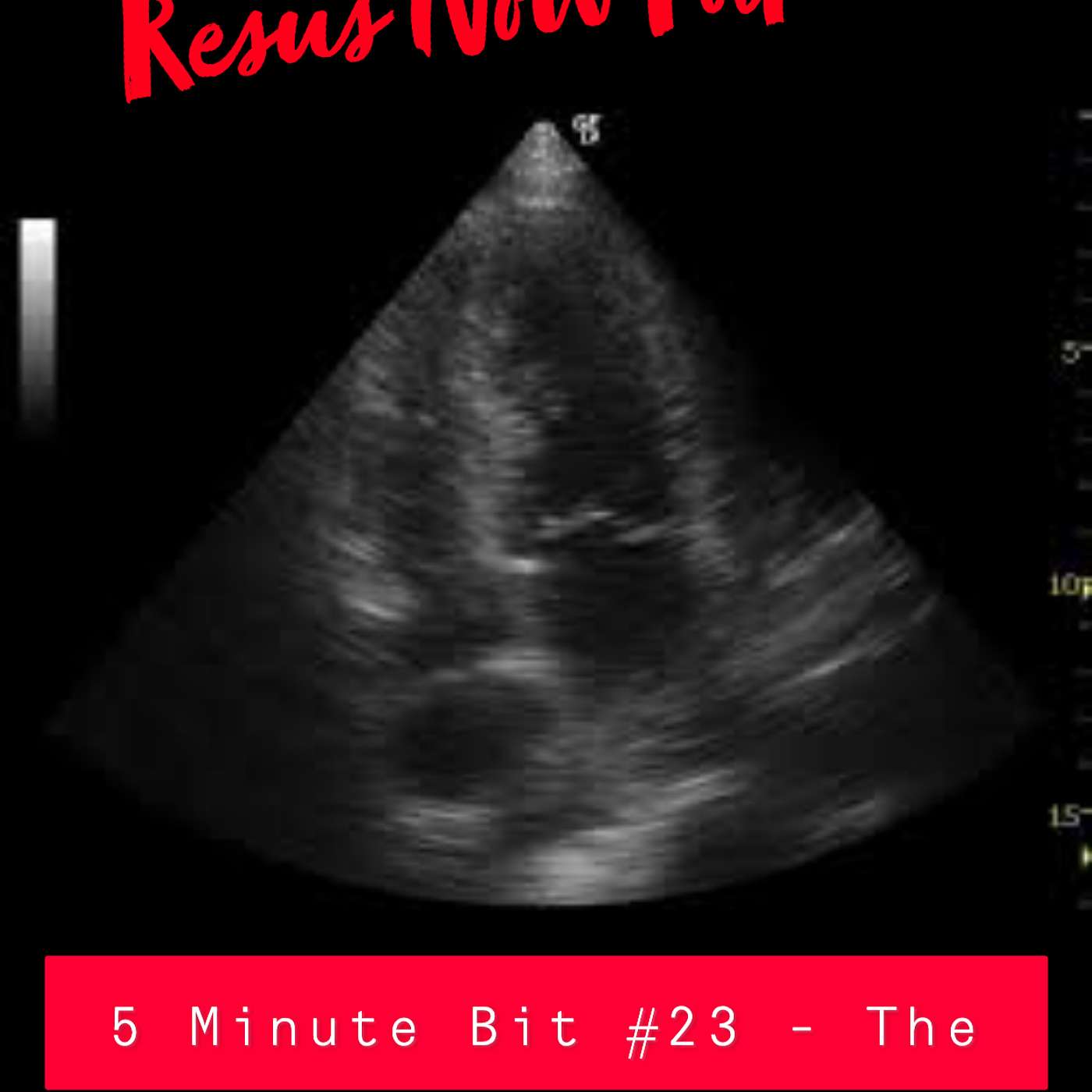 Resus Now