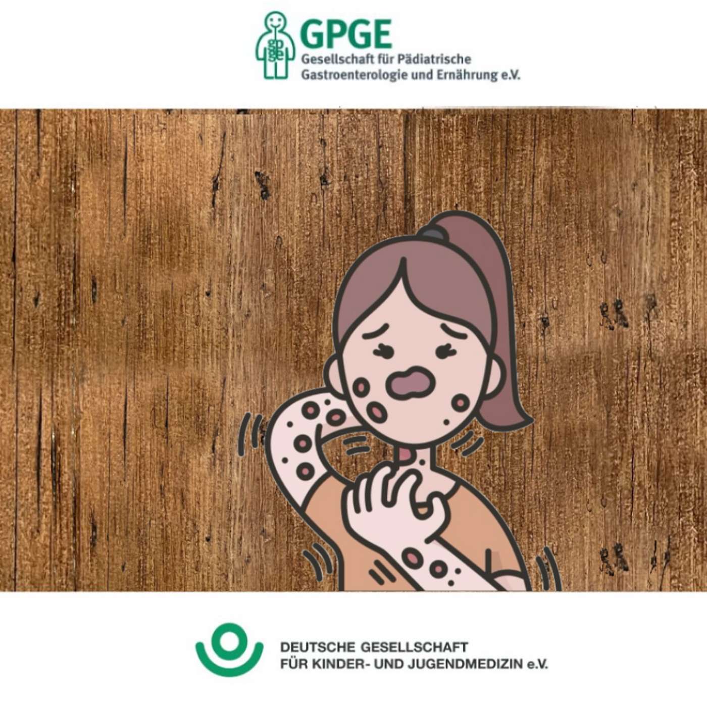 Neurodermitis (Teil I von II: Grundlagen & Diagnostik)