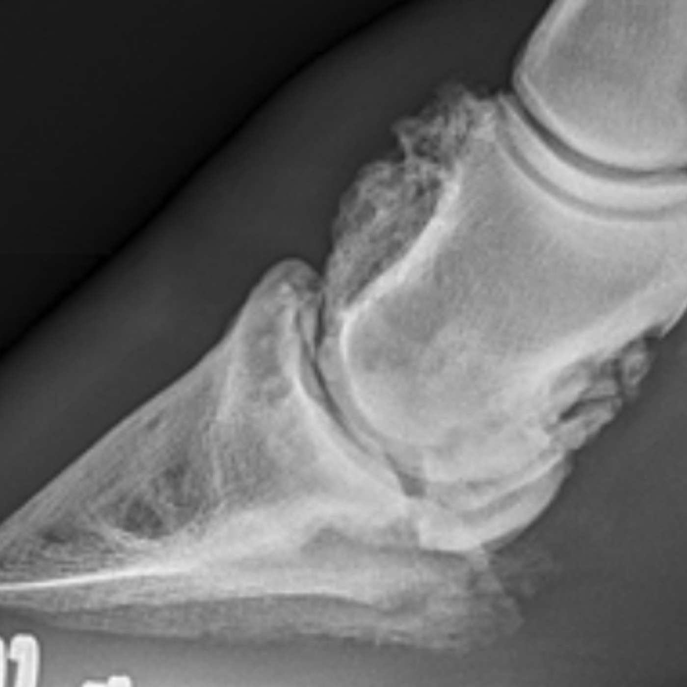 🇪🇸 Episodio 4 - Artritis de la articulación del casco