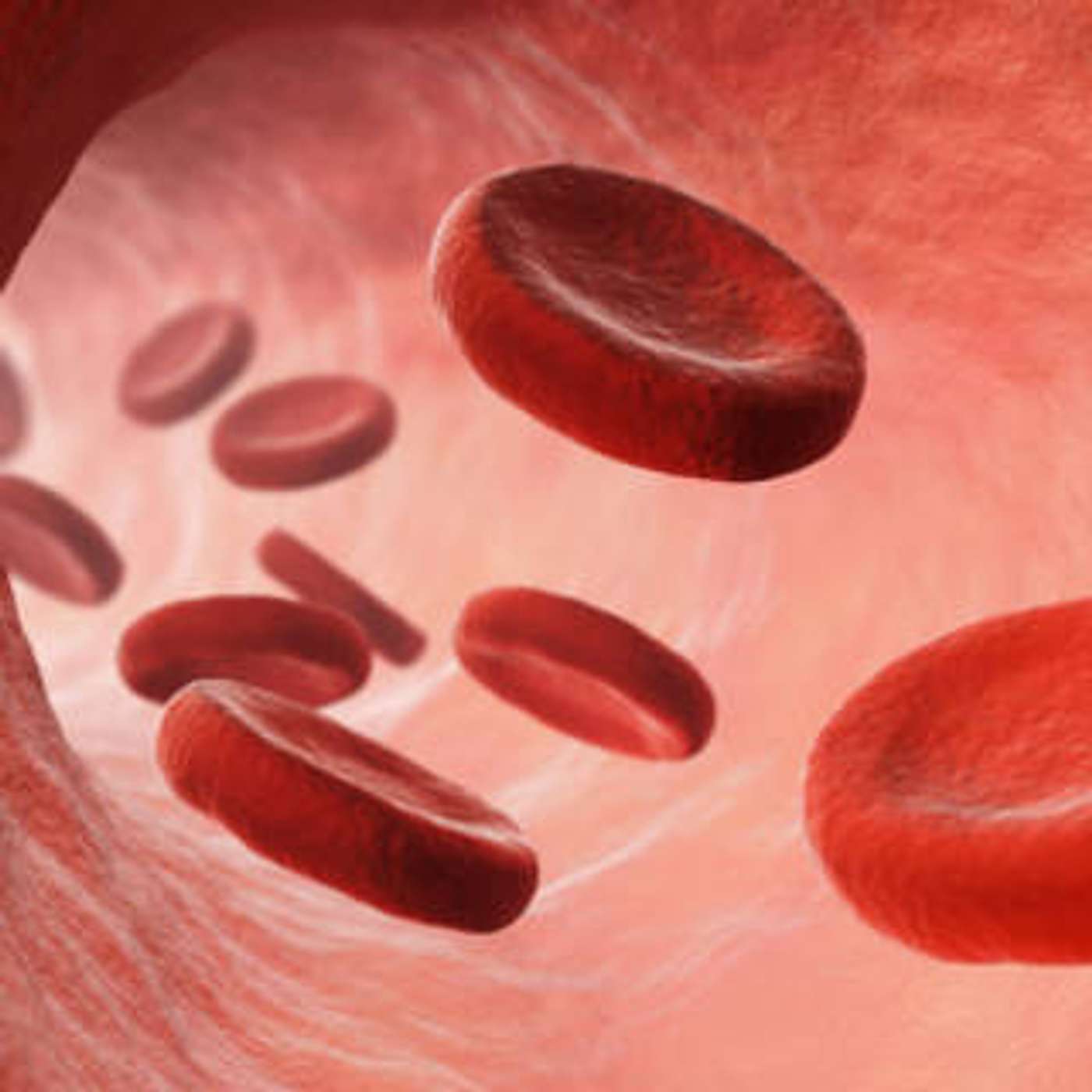 cover of episode Vasculitis