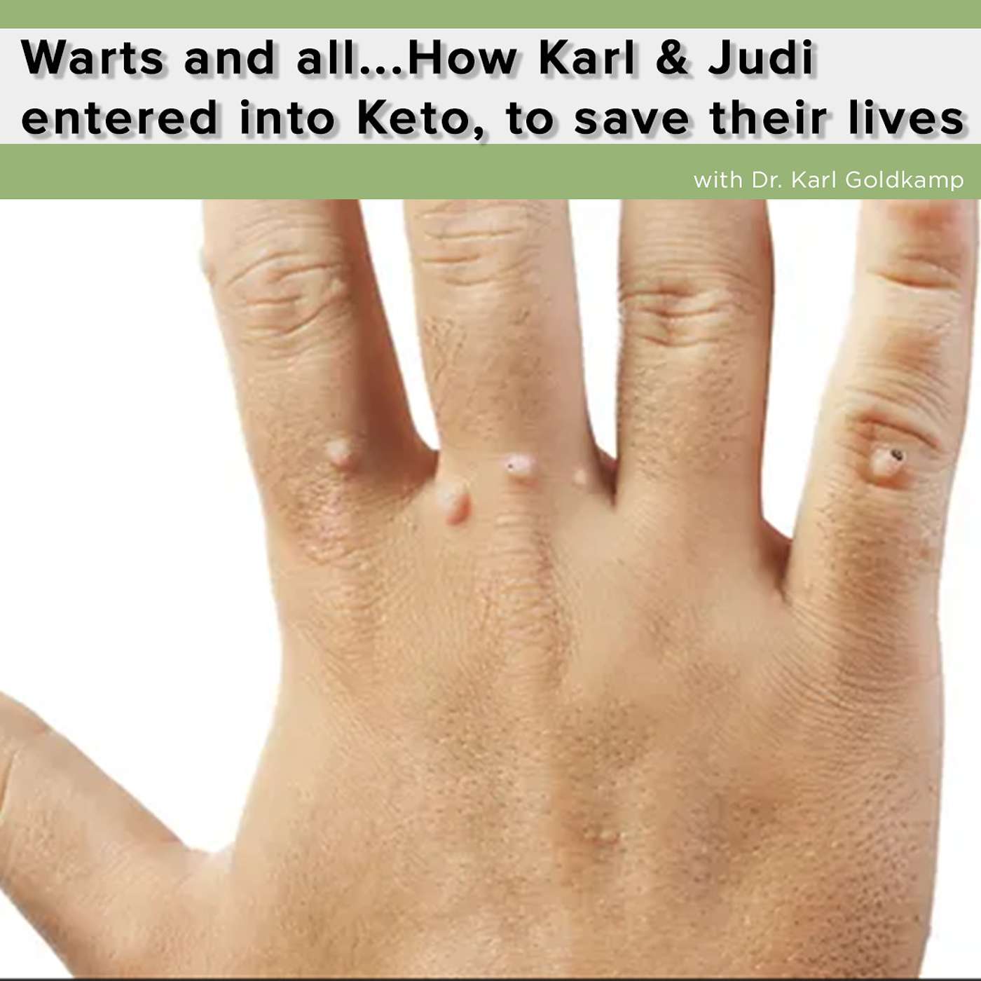 Warts and all...How Karl & Judi entered into Keto, to save their lives. episode artwork