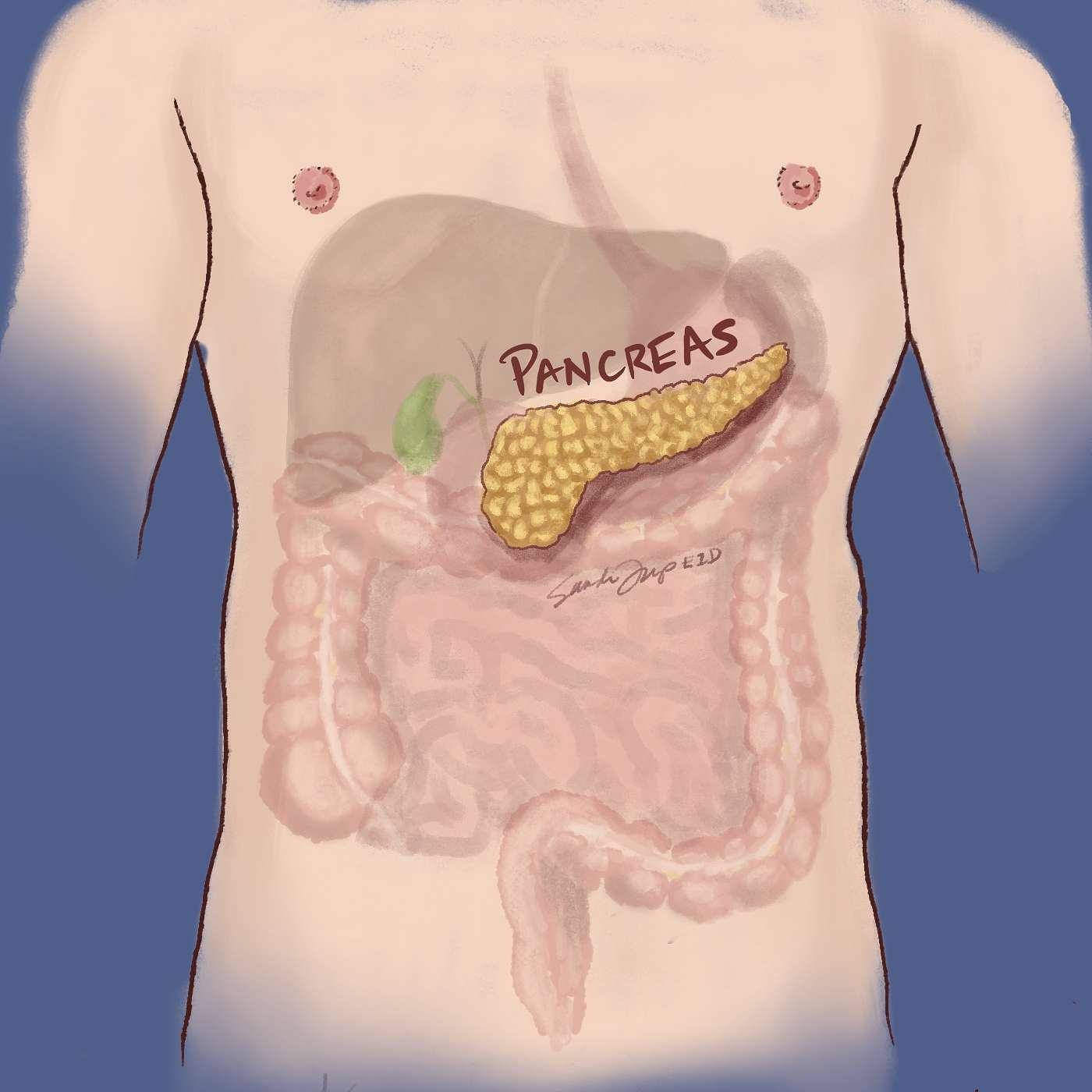 Pancreatic Cancer: From Diagnosis and the Whipple Procedure to Hospice Care