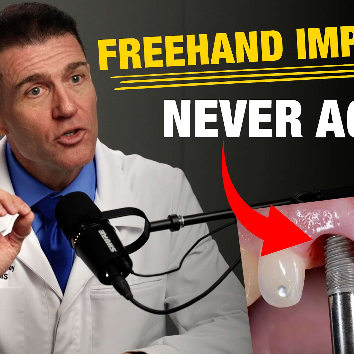 Implants Made Simple