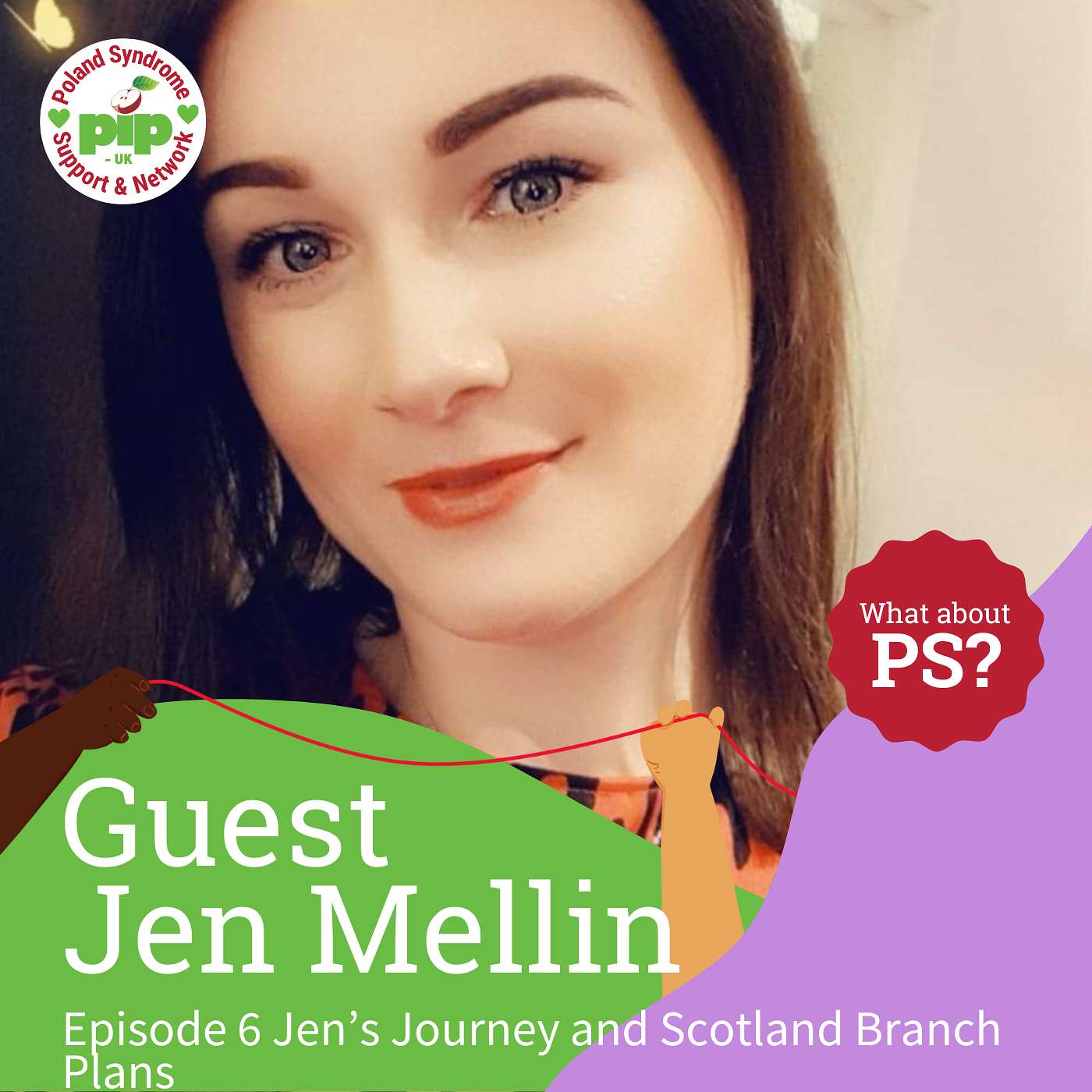 Season 2 - Ep 1 Scotland's Poland Syndrome Advocate: Jen's Inspiring Journey episode artwork