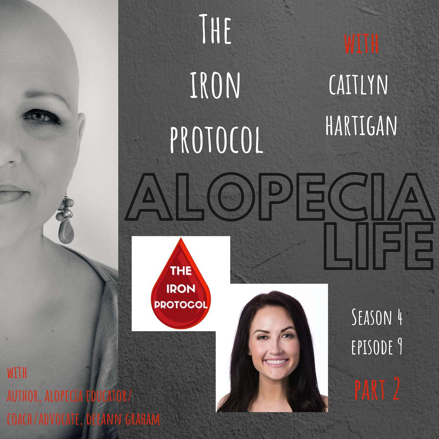 Alopecia Life