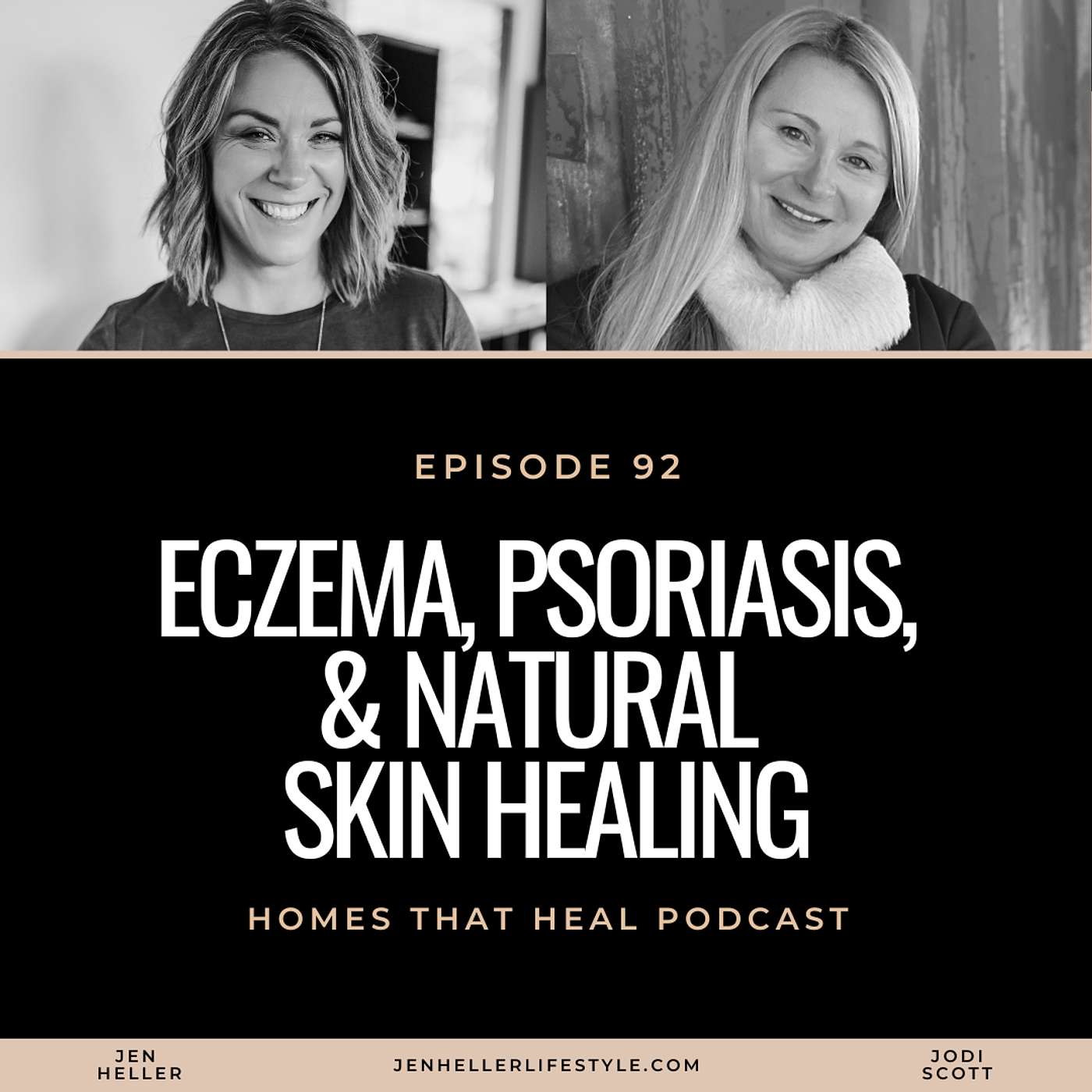 Ep 92: Eczema, Psoriasis, & Natural Skin Healing: Plant-Based Remedies That Work with Jodi Scott