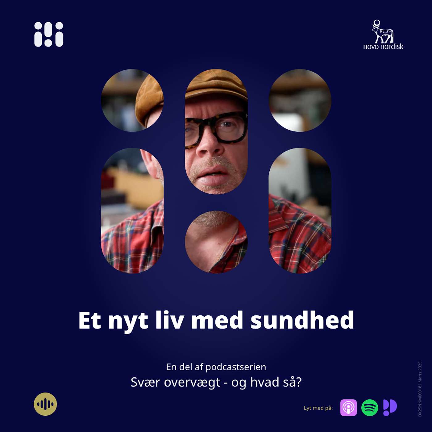 Svær overvægt... Og hvad så?