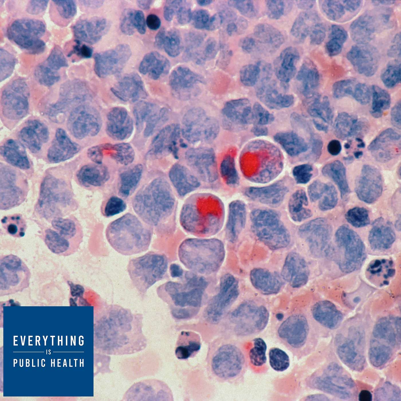 Public Health in Retrograde - Coffee in Your Butt Can't Cure Your Cancer