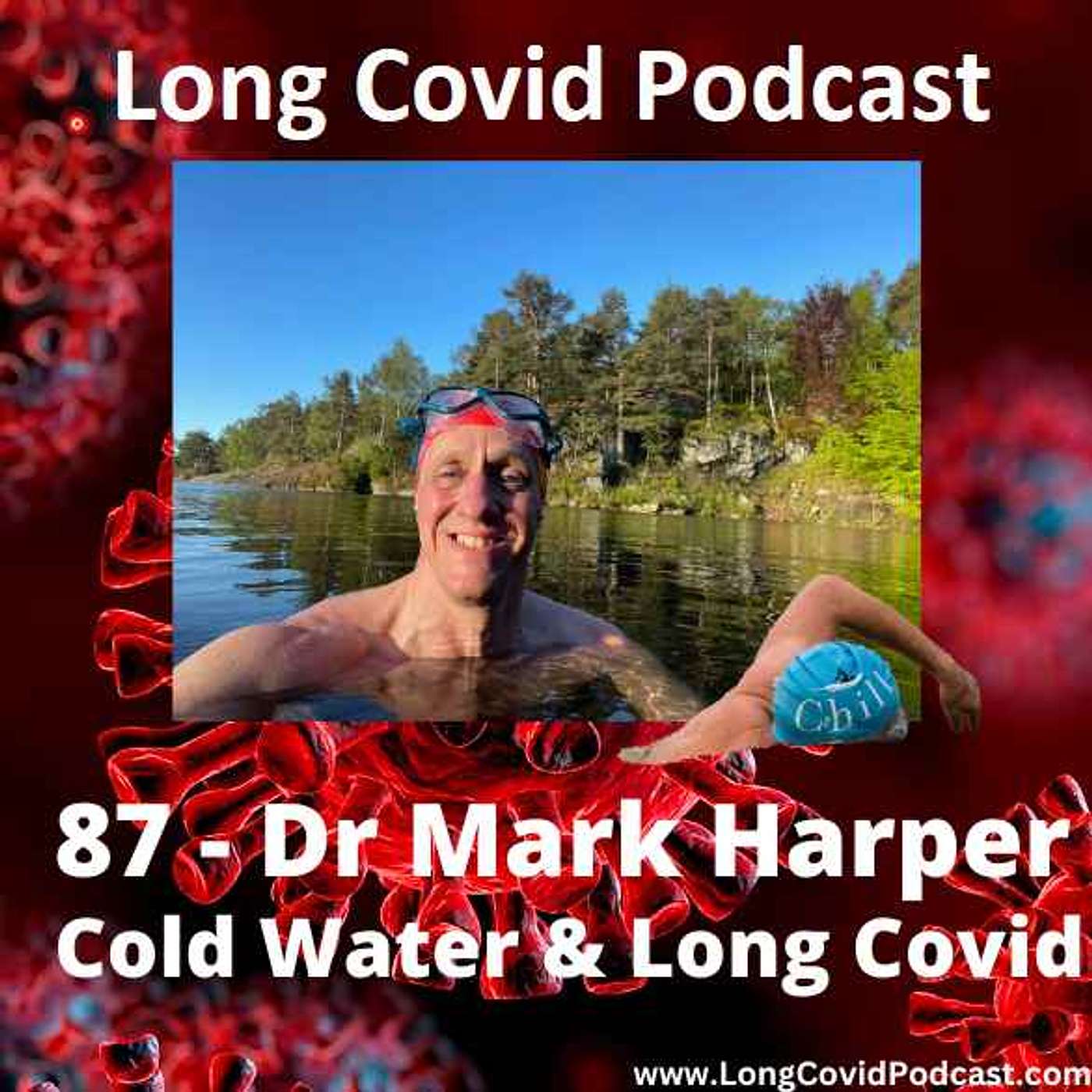 87 - Dr Mark Harper - Cold Water & Long Covid