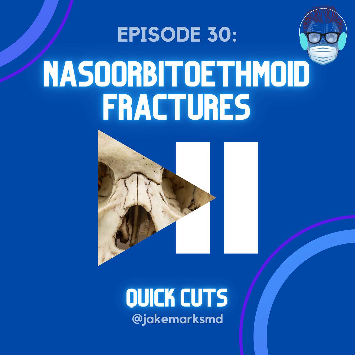 Quick Cuts: A Plastic Surgery Podcast - Episode 30: Nasoorbitoethmoid Fractures