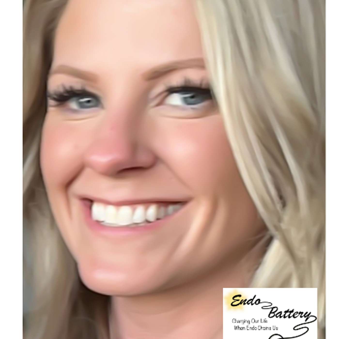 Gaslit, Misdiagnosed, Mind Games, and Lingering Effects of Endo are All Part of Chelsea's Story episode artwork
