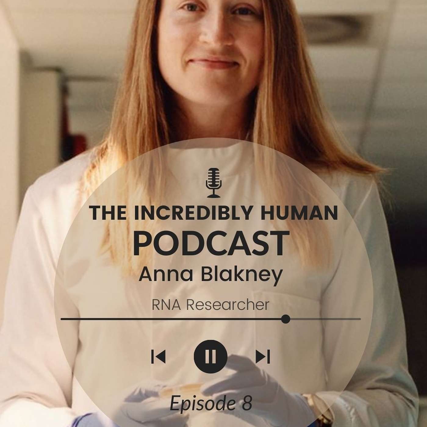 Are the mRNA vaccines safe? Are the mRNA vaccines safe?