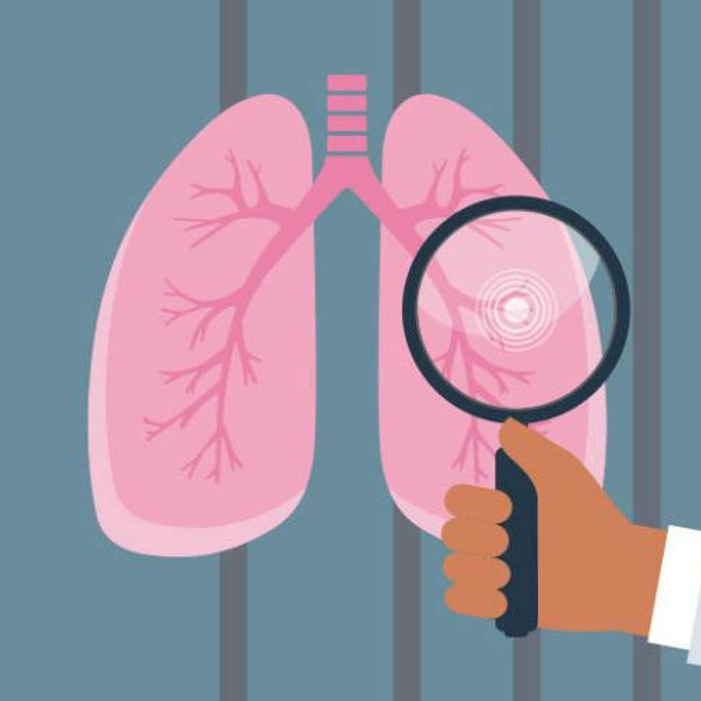 Lung Cancer: What you should know