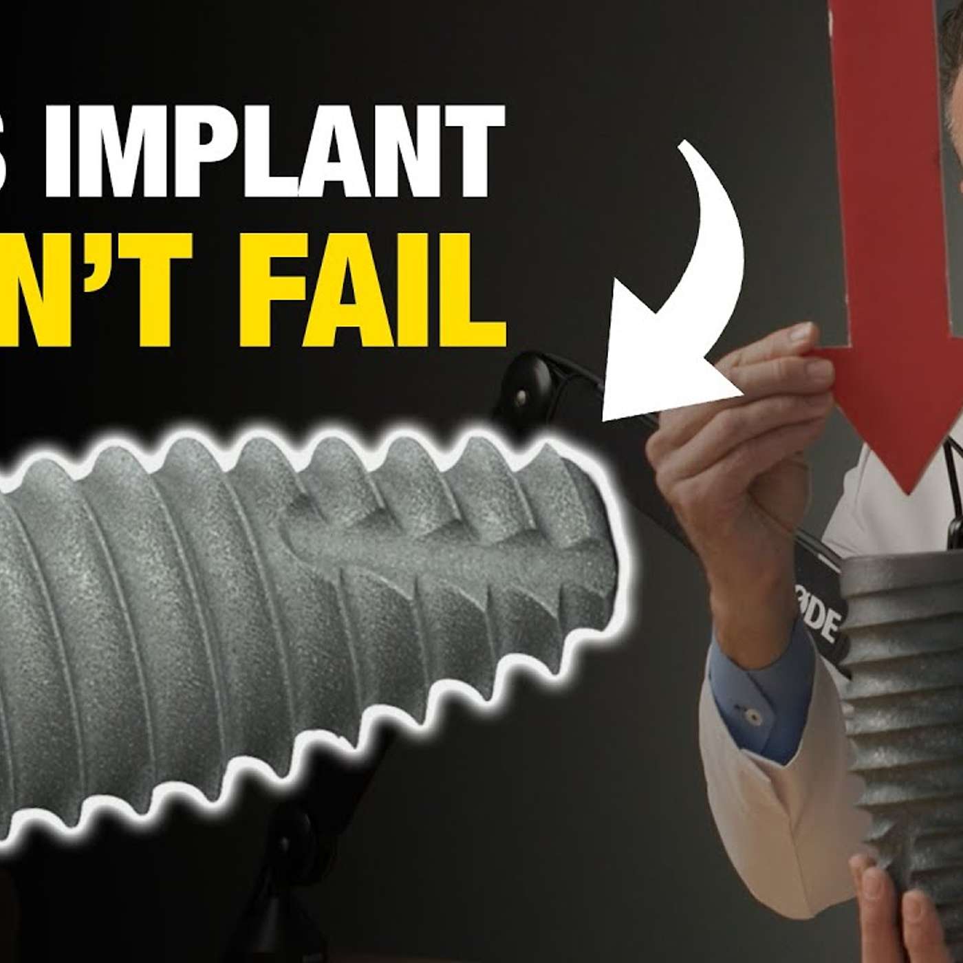 Implants Made Simple