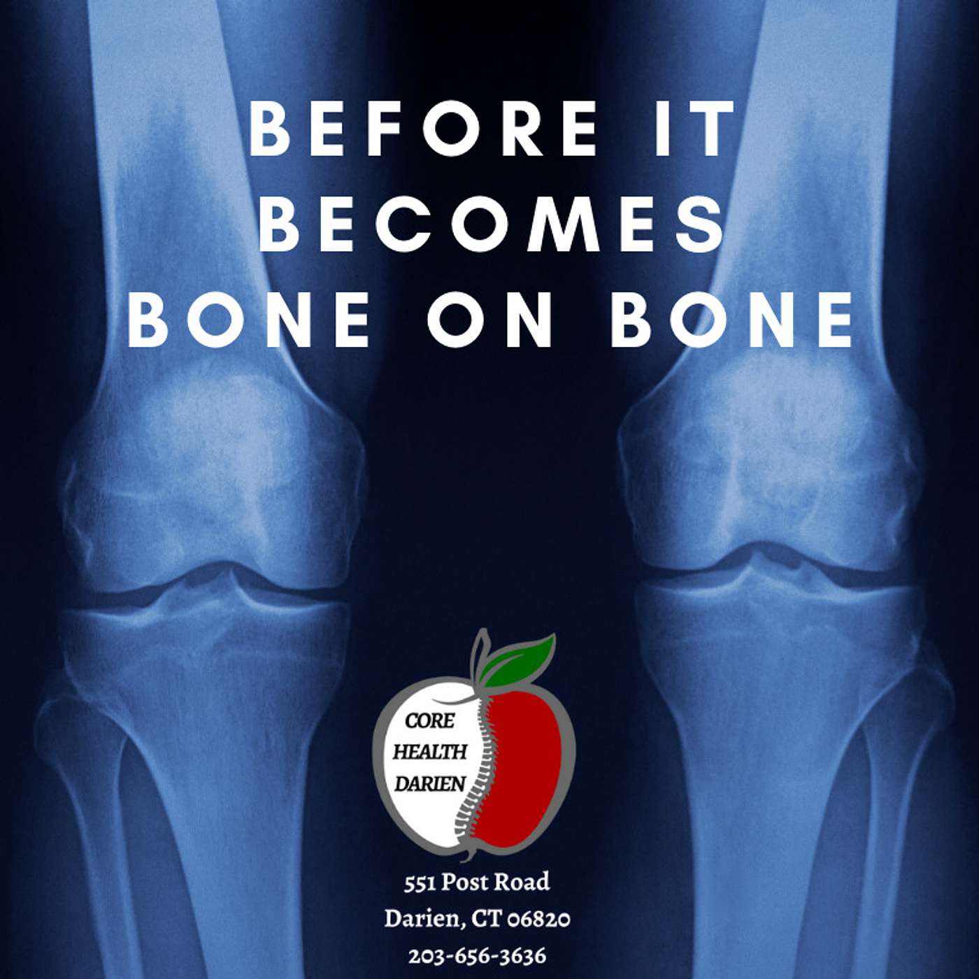 Stamford, Darien, Norwalk, New Canaan Runner's Knee Pain episode artwork