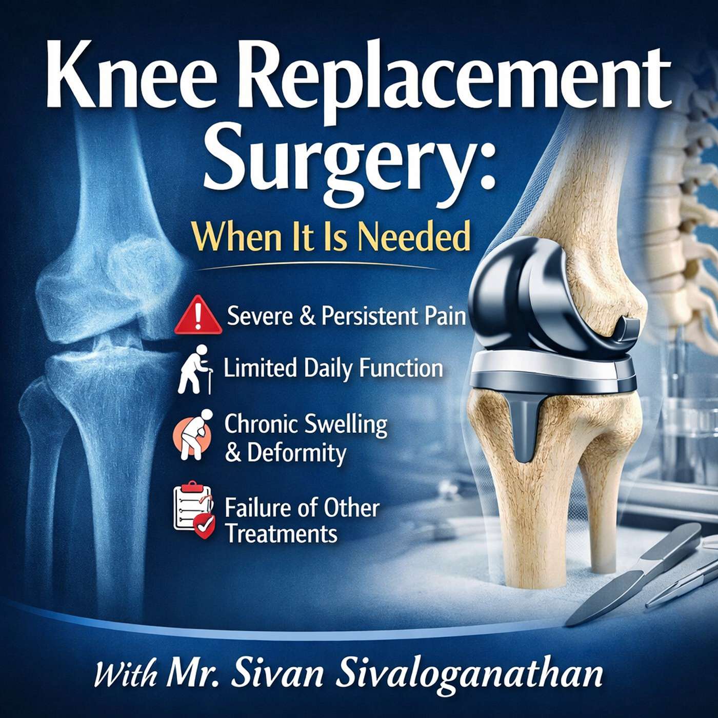 Knee Replacement Surgery: When It Is Needed cover art