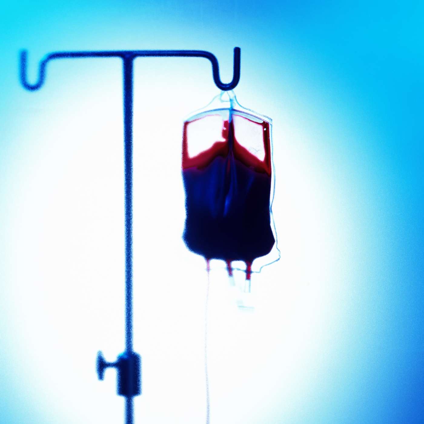 Ep158: Iron infusions and fracture risk. A safety signal for ferric carboxymaltose