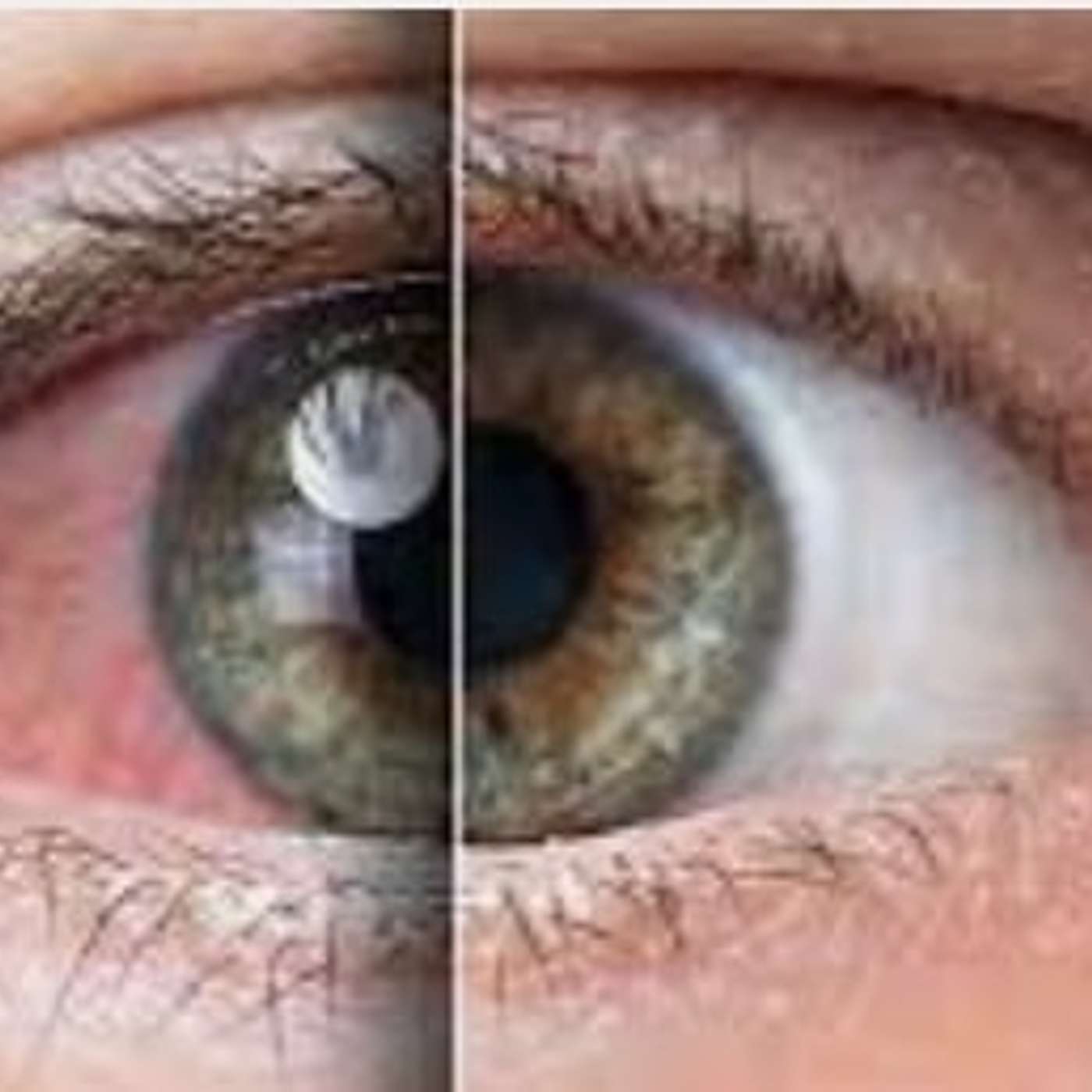 Investigating Crystals for Eye Health