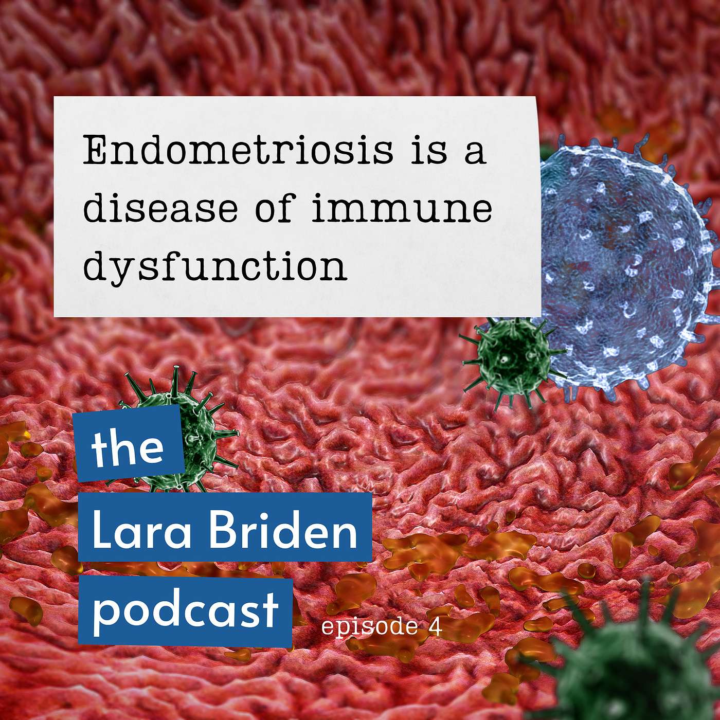 Endometriosis is a disease of immune dysfunction