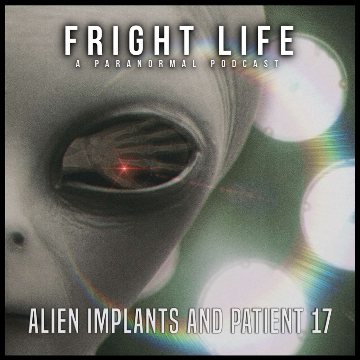 Episode 102: Alien Implants episode artwork