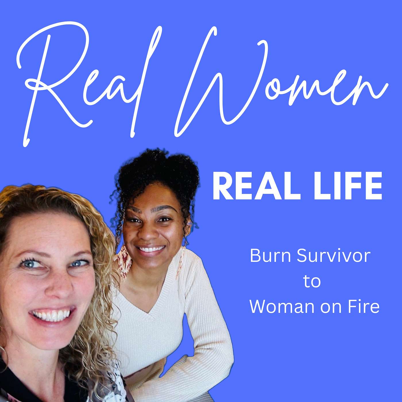 Burn Survivor to Woman on Fire pt 2