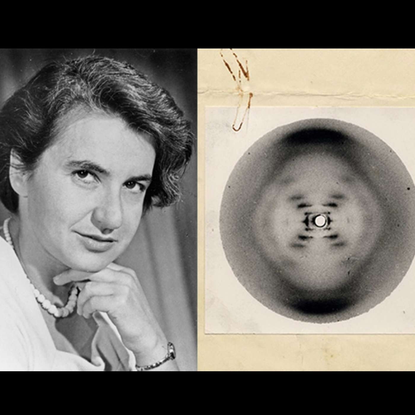 Rosalind Franklin- Who Saw The Secret of Life