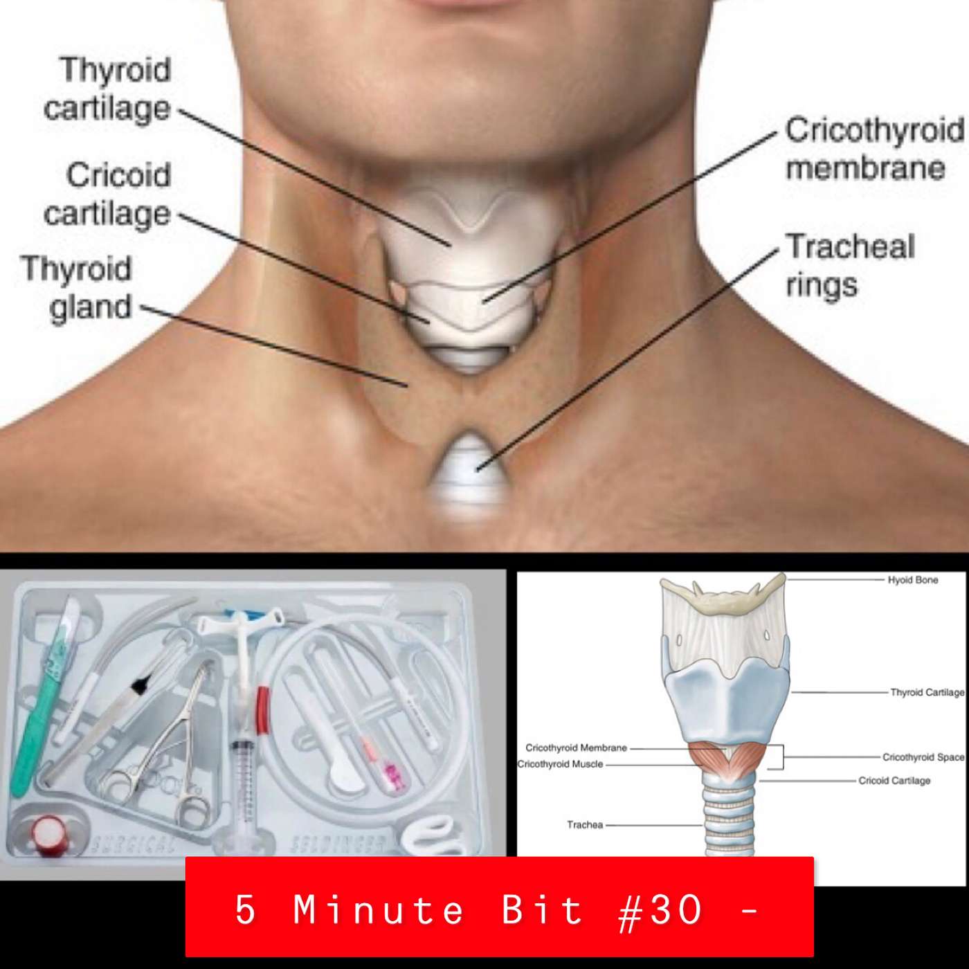 Resus Now