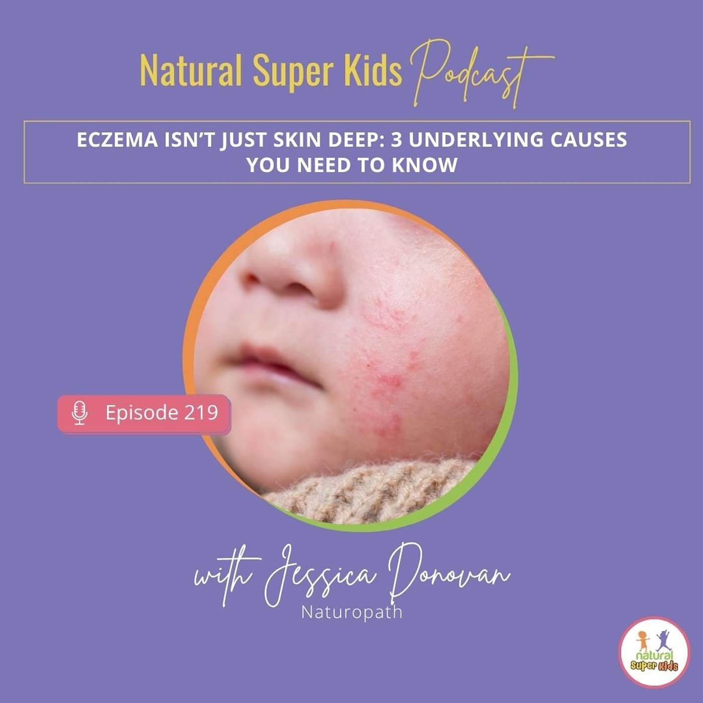 Episode 219: Eczema Isn’t Just Skin Deep: 3 Underlying Causes You Need to Know