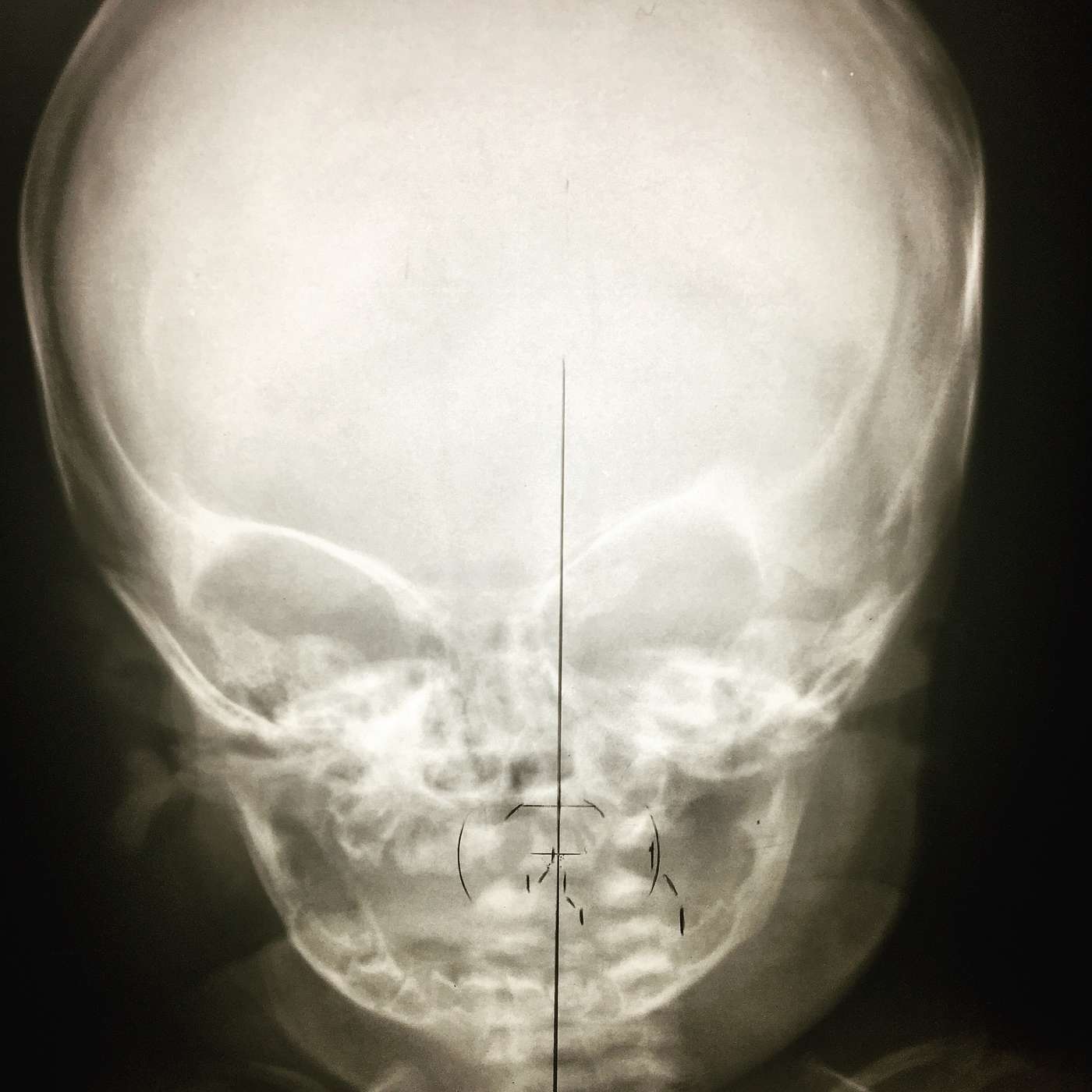 Lifeline to Vitality