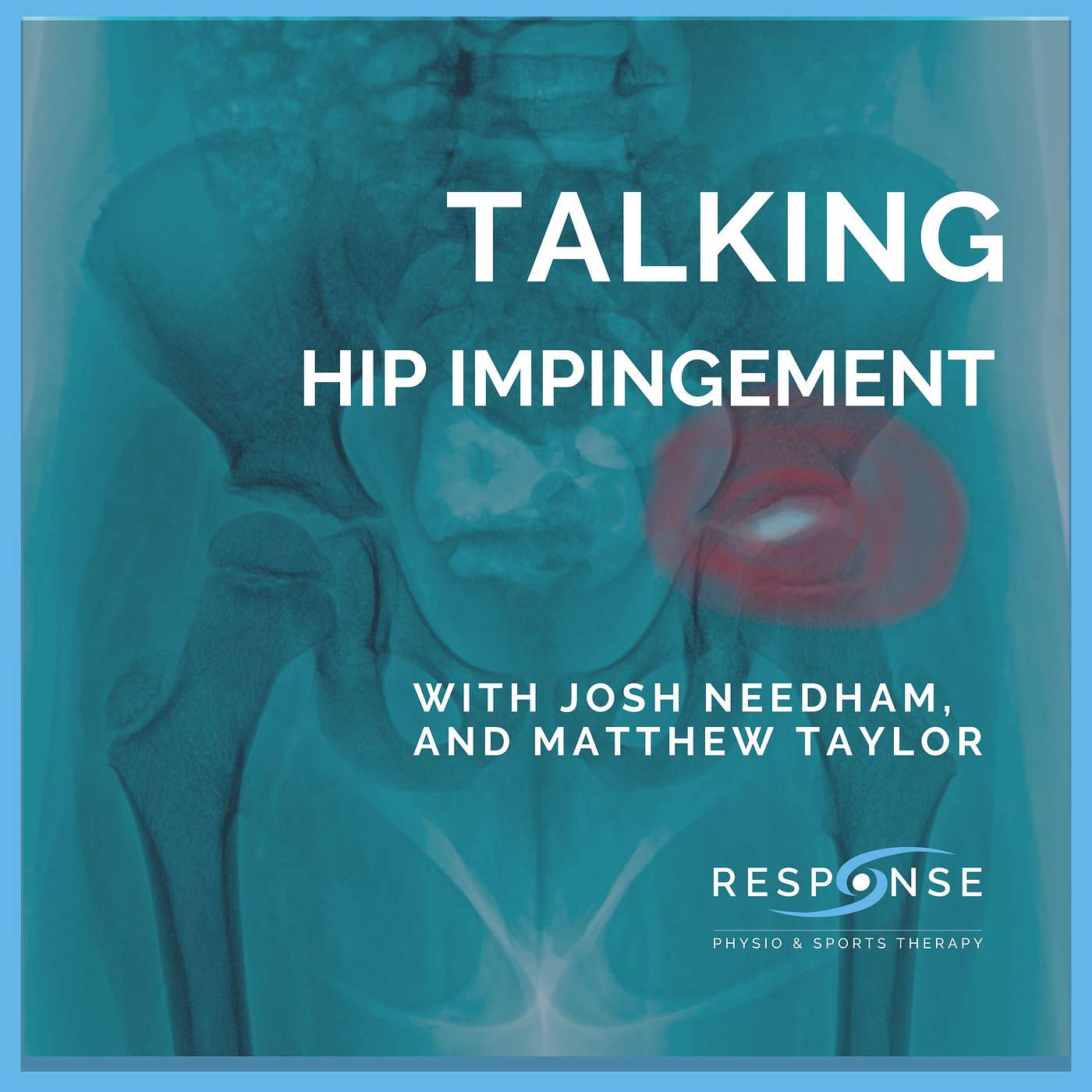Hip impingement episode artwork