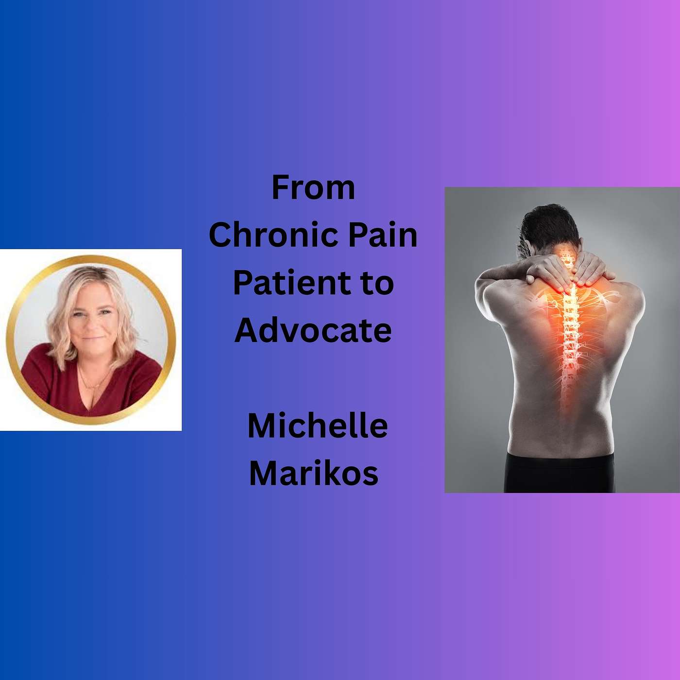 Ep. 219 From Chronic Pain to Patient Advocate with Michelle Marikos