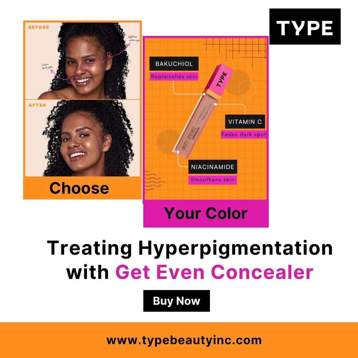 Treating Hyperpigmentation with Get Even Concealer podcast artwork