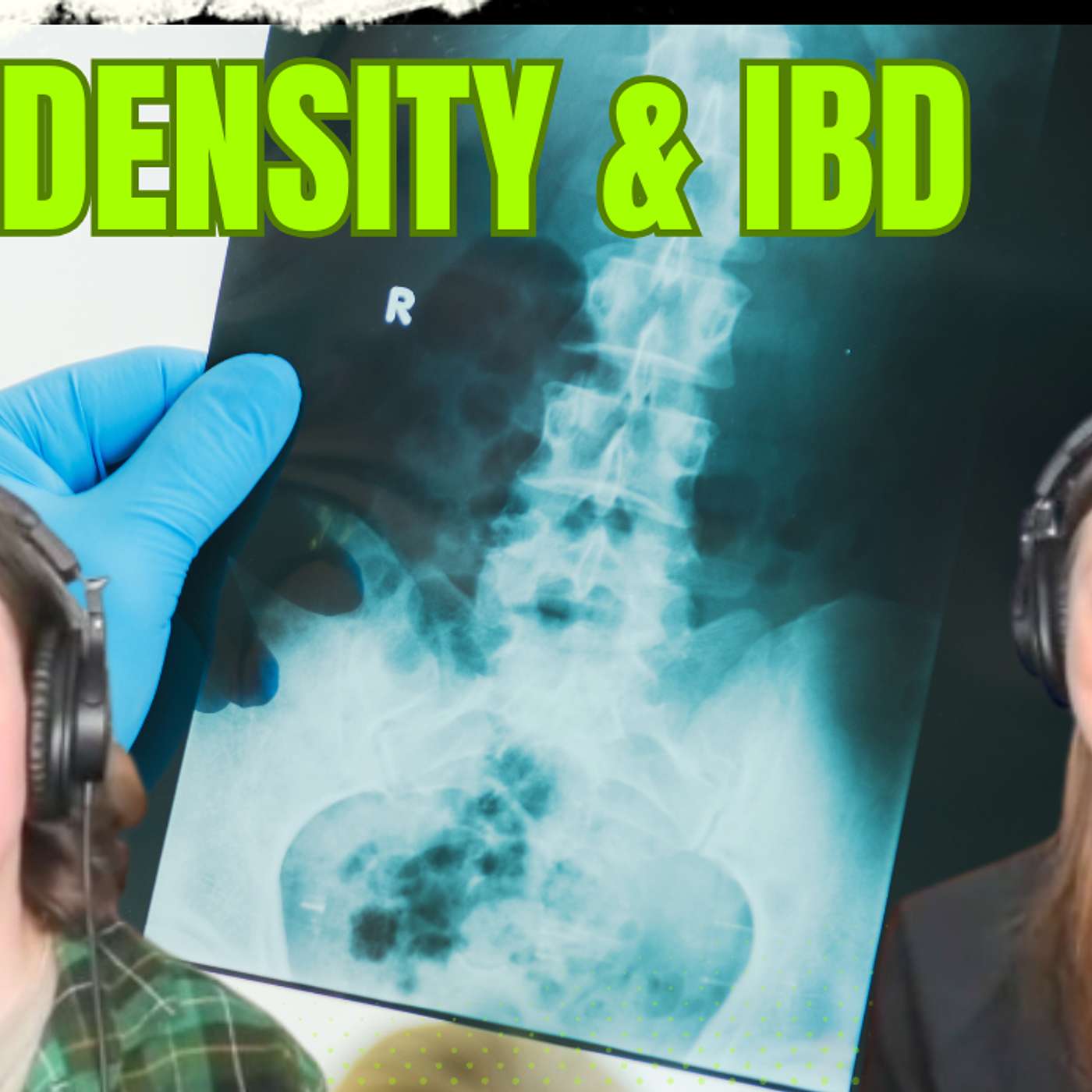 IBDetermined