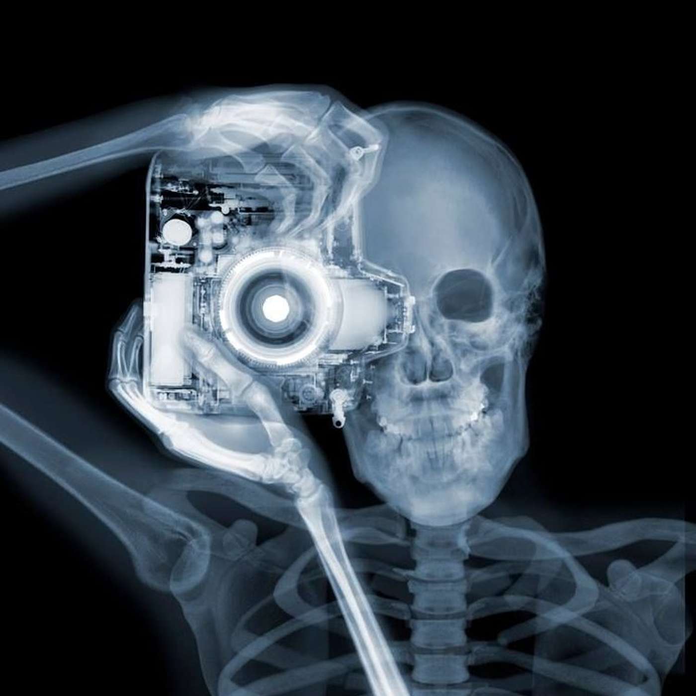 My Other Chiropractor Didn't Take X-rays, Why Do You?