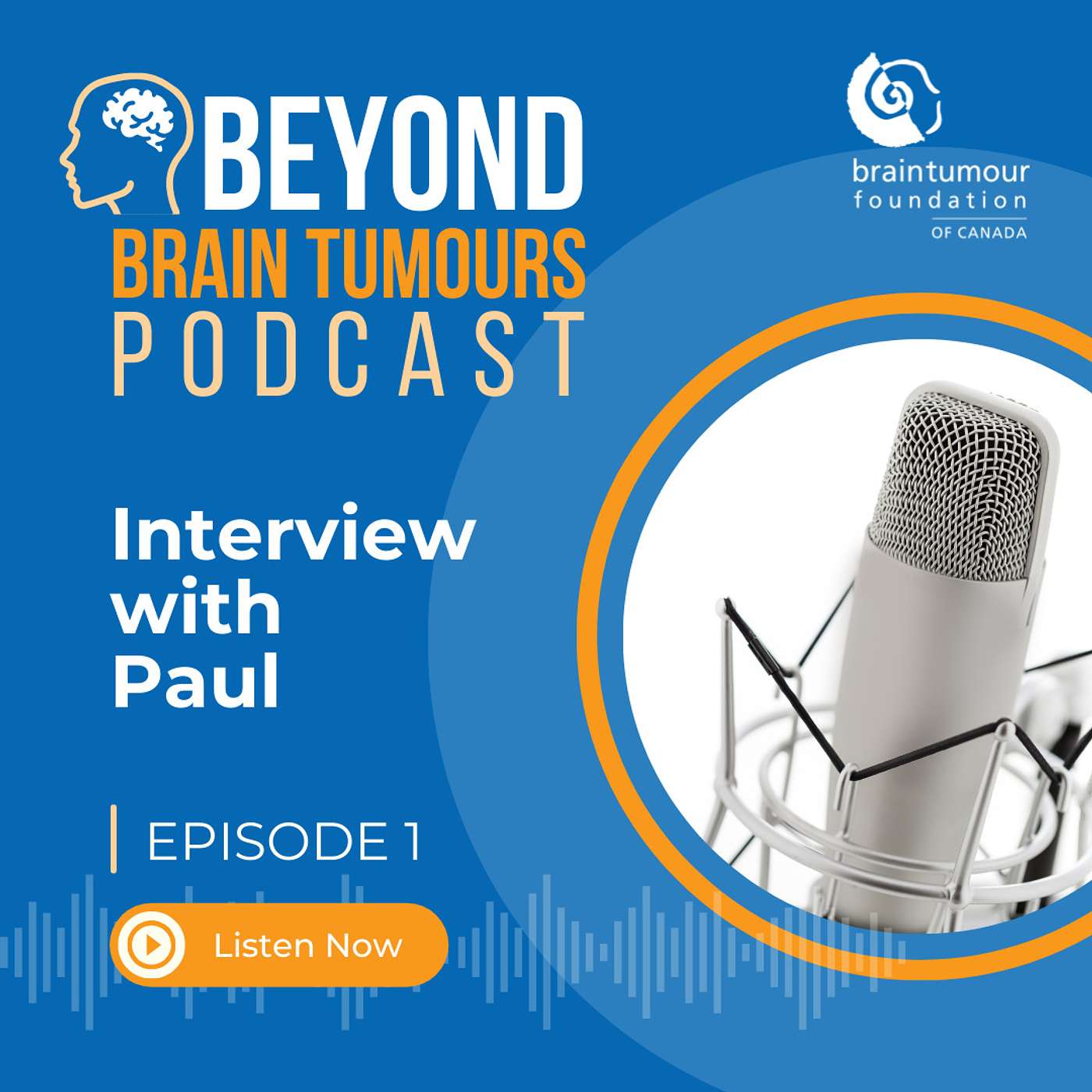 Beyond Brain Tumours