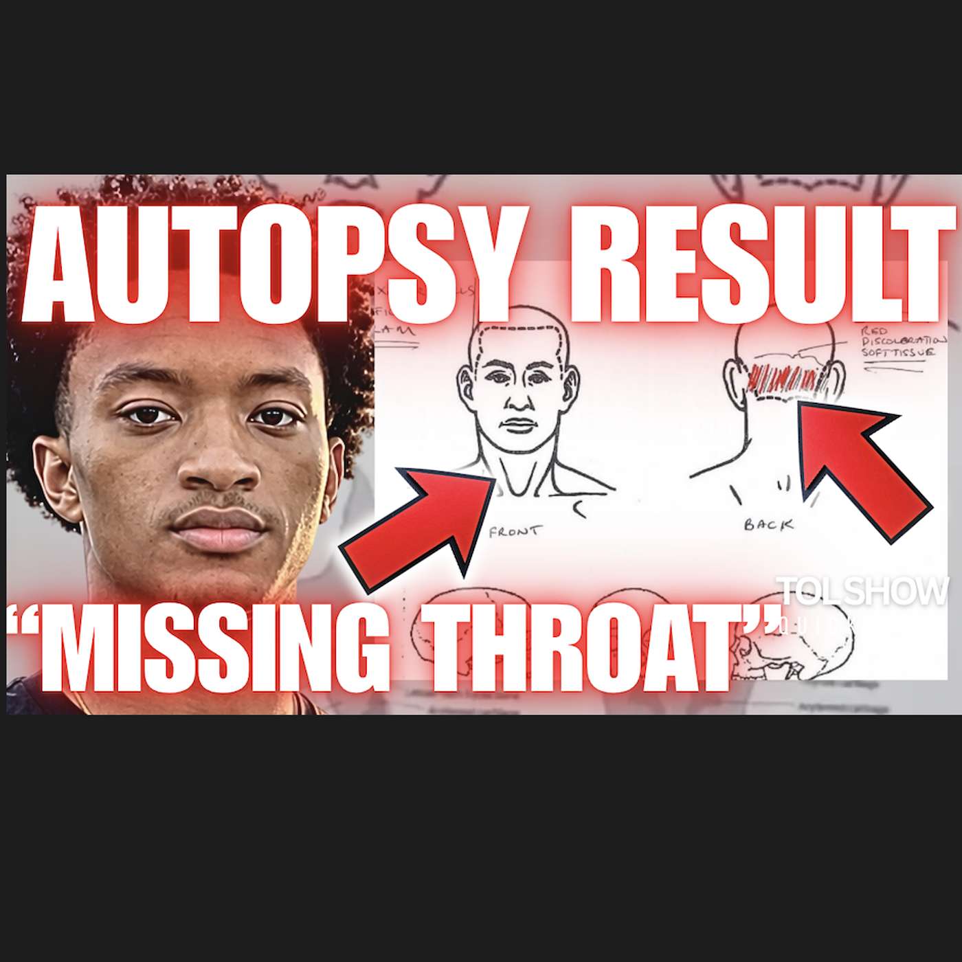 Nolan Wells FULL Autopsy RESULTS Warren SPEAKS‼️ episode artwork
