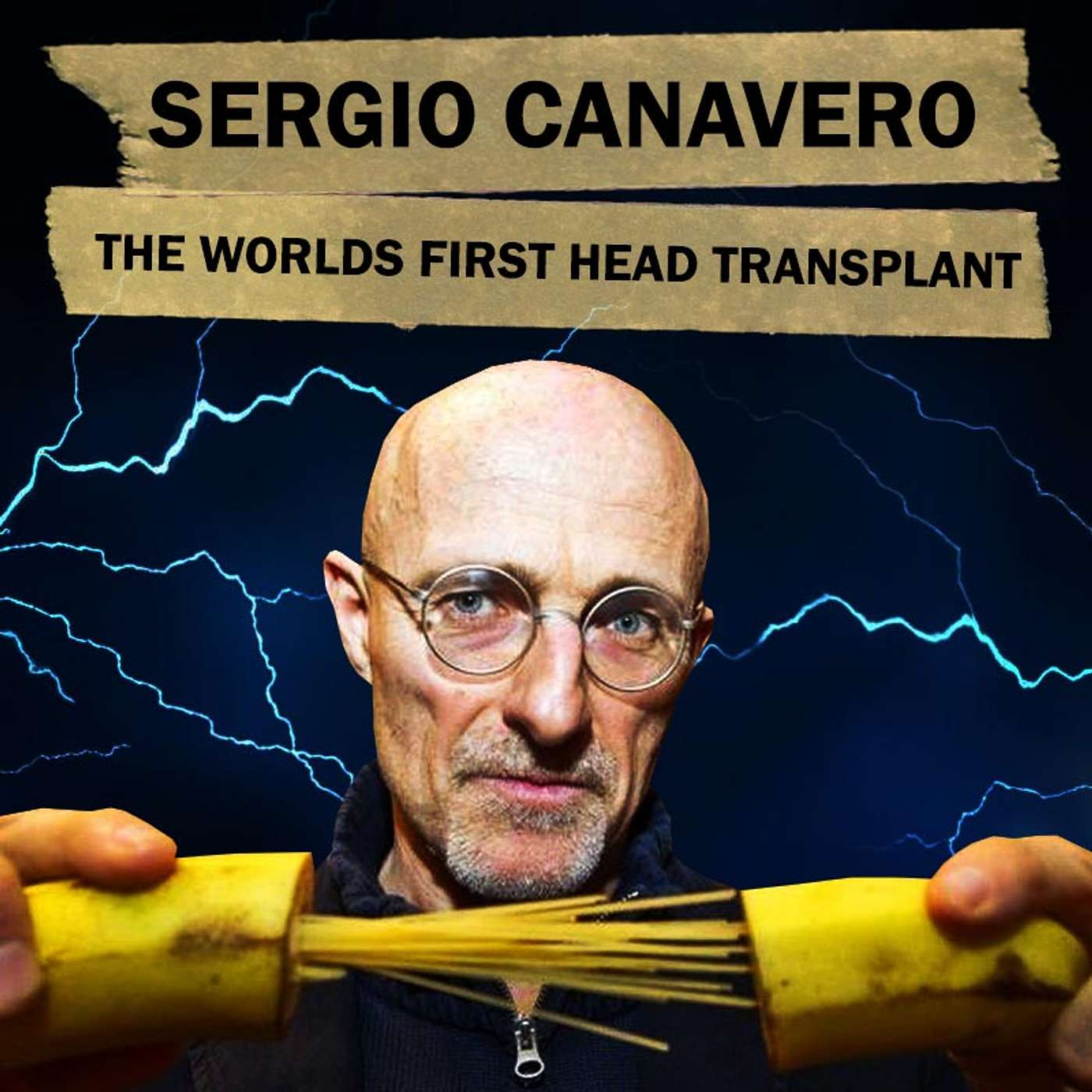 Sergio Canavero and the Worlds First Human Head Transplant