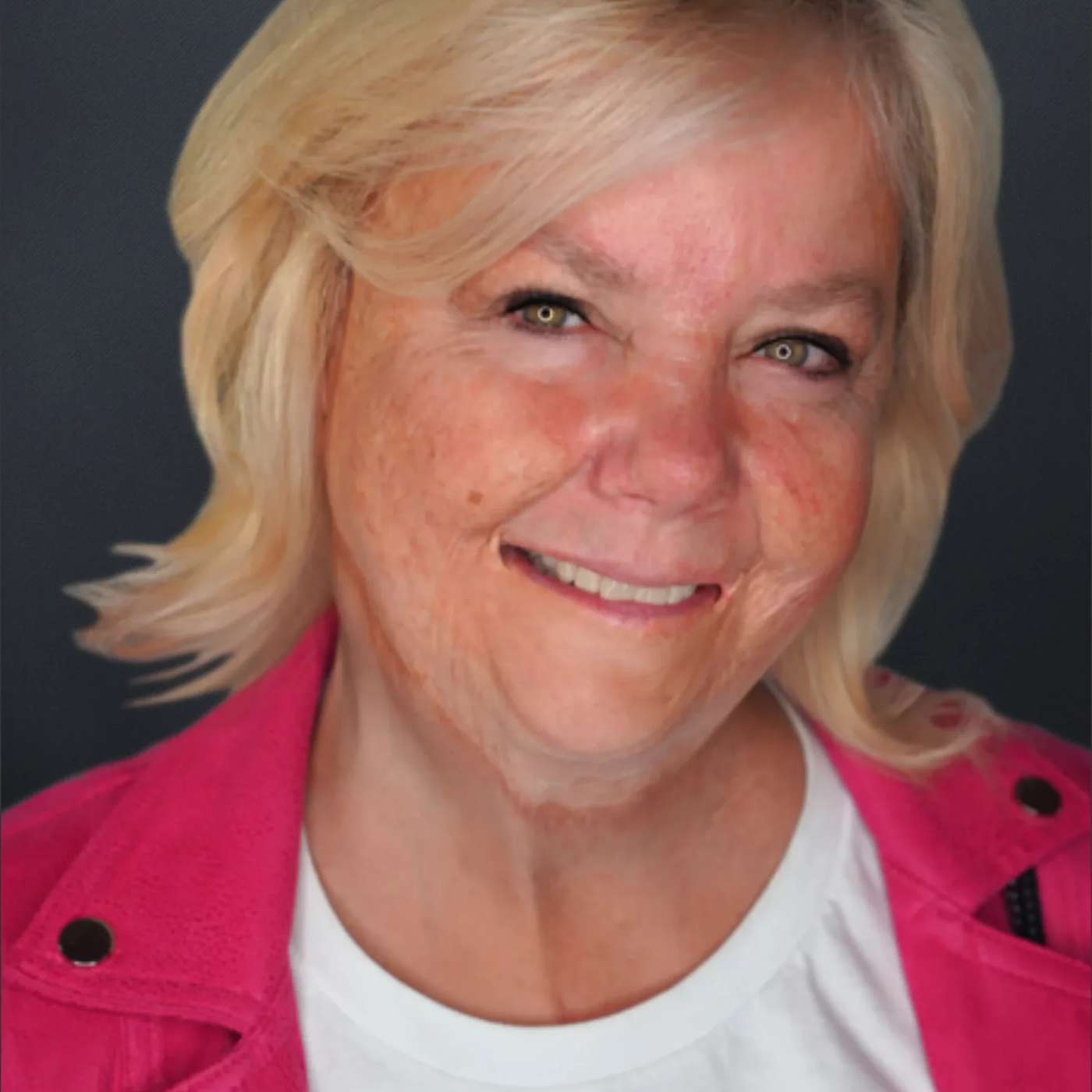 4- Rediscover Your True Beauty After It All Gets Burned Away with Extreme Burn Survivor Kelly Falardeau