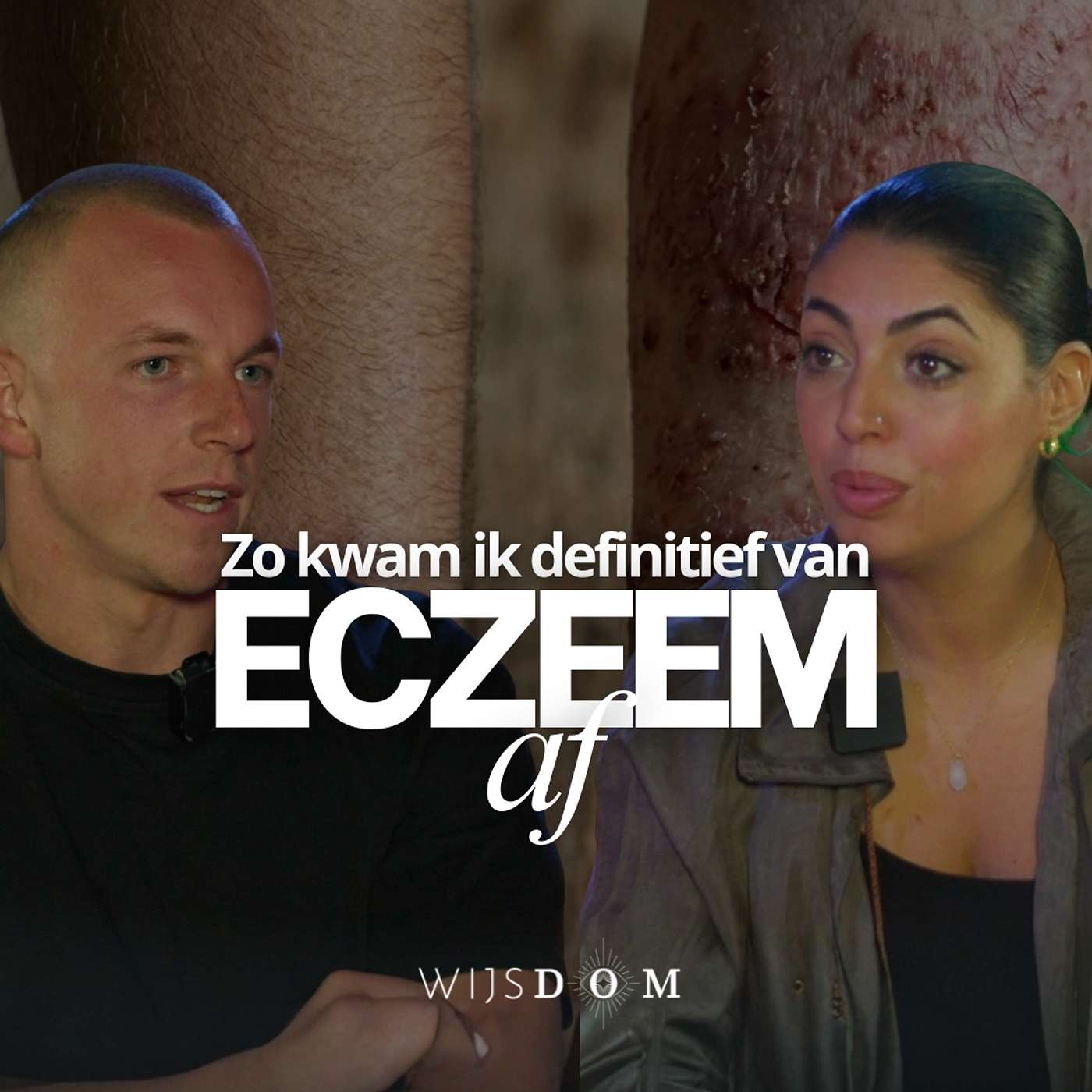Dit vertellen artsen je niet over jarenlang gebruik van hormoonzalf — Remy Ettema | WijsDom Podcast