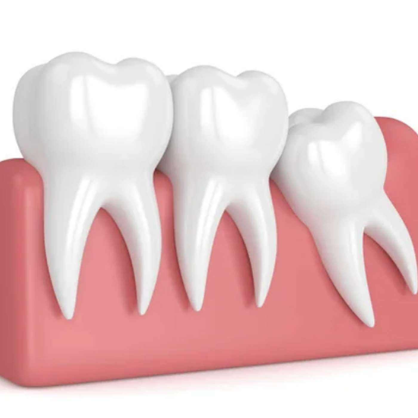 Wisdom Teeth: Should They Stay or Go? episode artwork