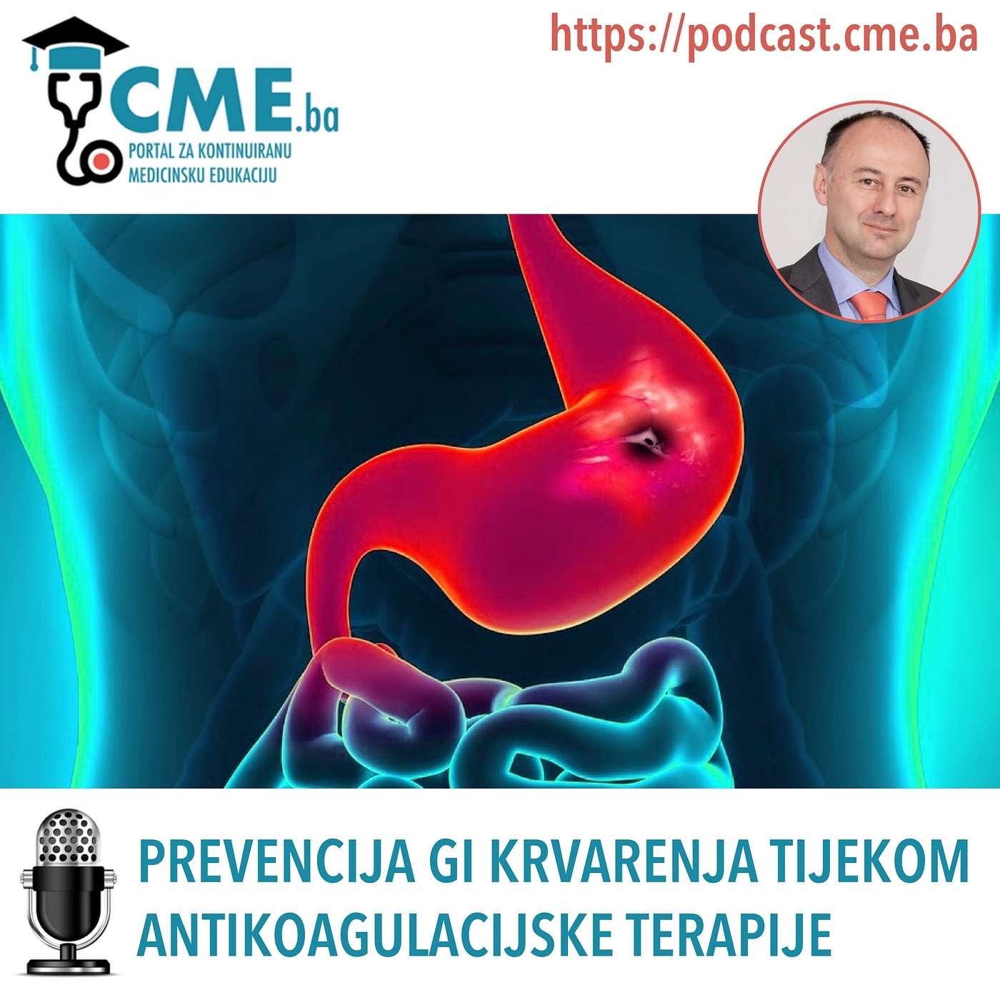 Prevencija GI krvarenja tijekom antikoagulacijske terapije