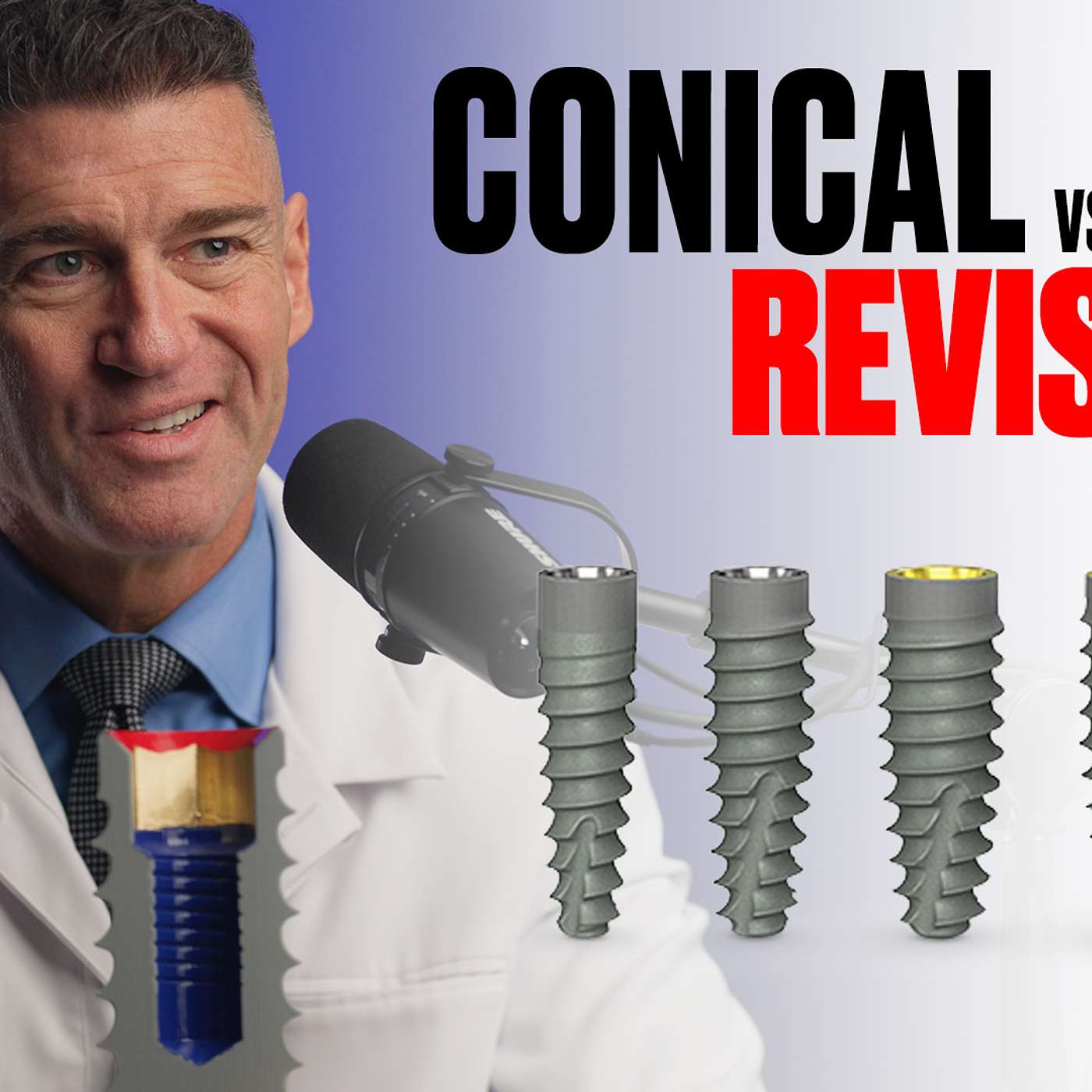 Implants Made Simple