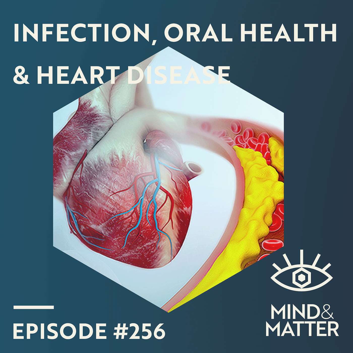Bacterial Infection, Oral Hygiene, Atherosclerosis & Heart Disease | Pekka Karhunen | 256