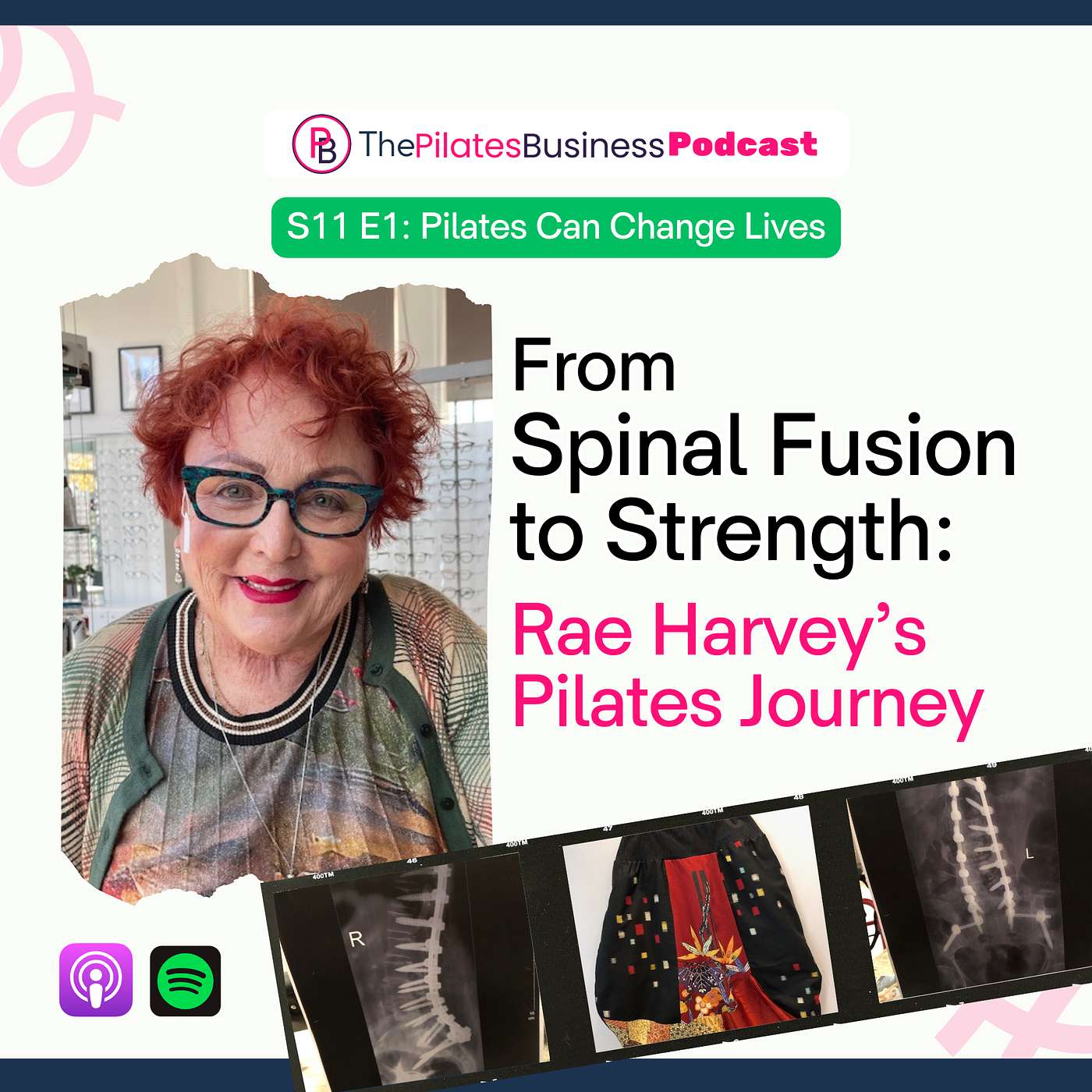 From Spinal Fusion to Strength: Rae Harvey’s Pilates Journey