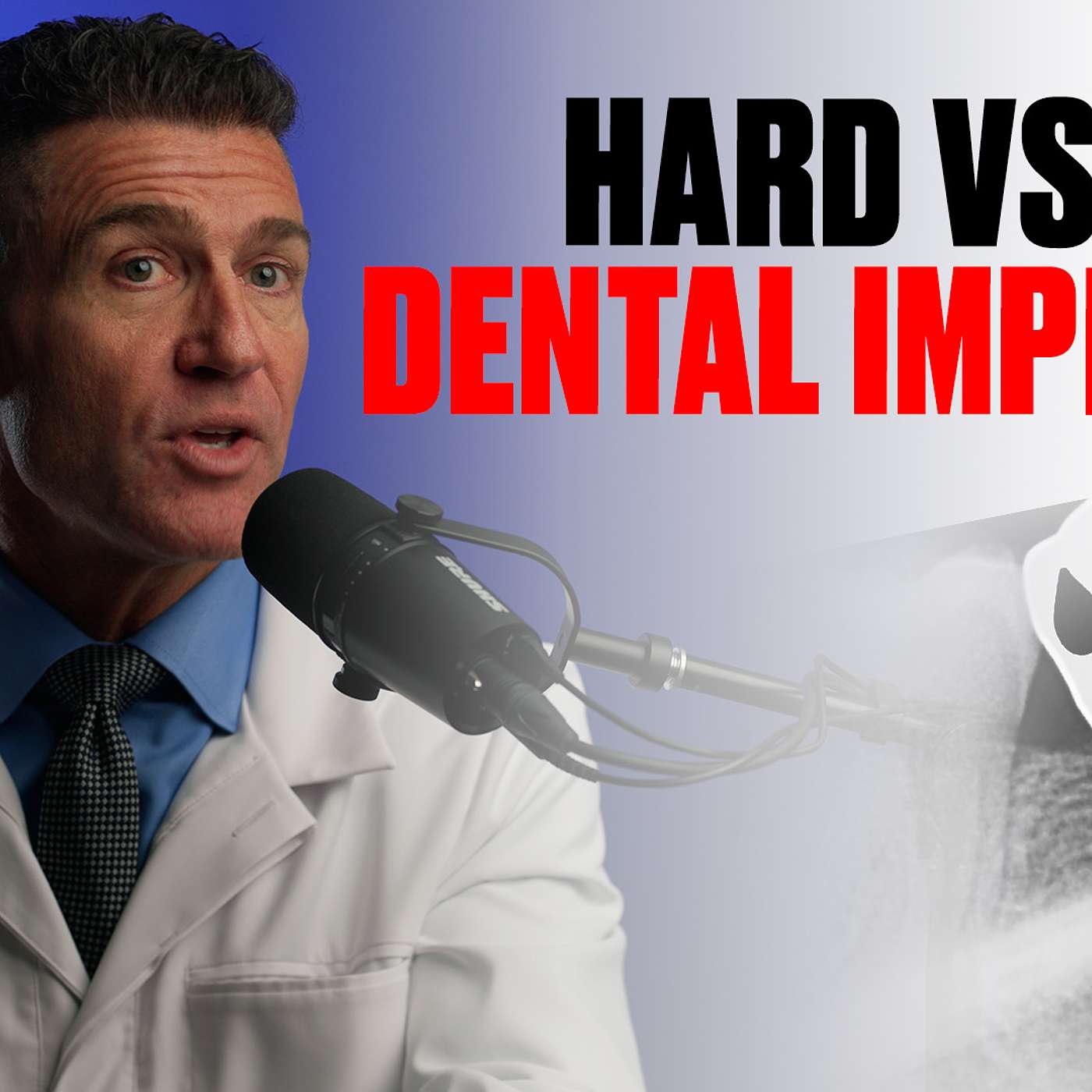 Implants Made Simple