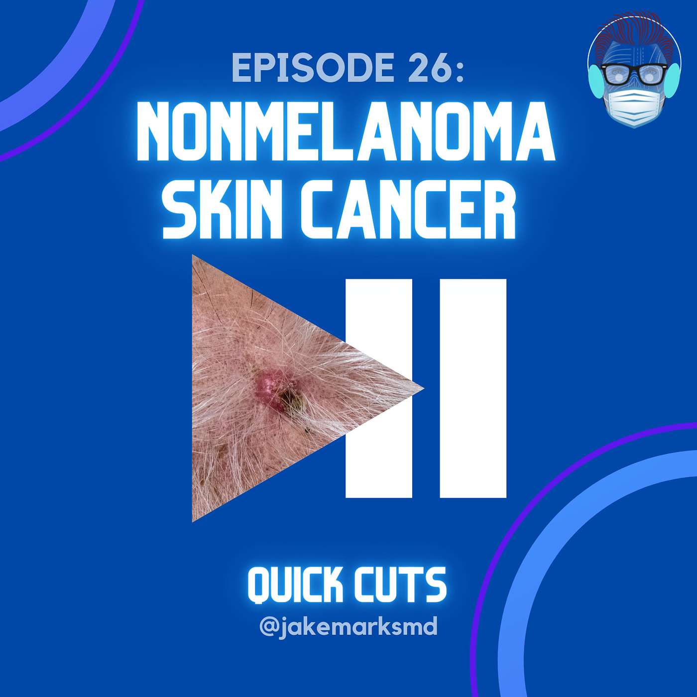 Quick Cuts: A Plastic Surgery Podcast - Episode 26: Nonmelanoma Skin Cancer