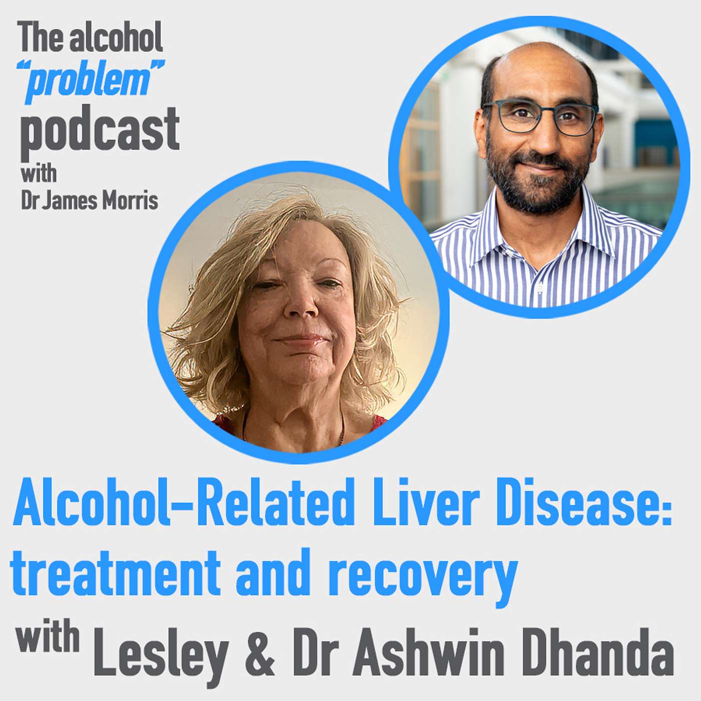 Alcohol-Related Liver Disease: treatment and recovery with Lesley & Dr Ashwin Dhanda