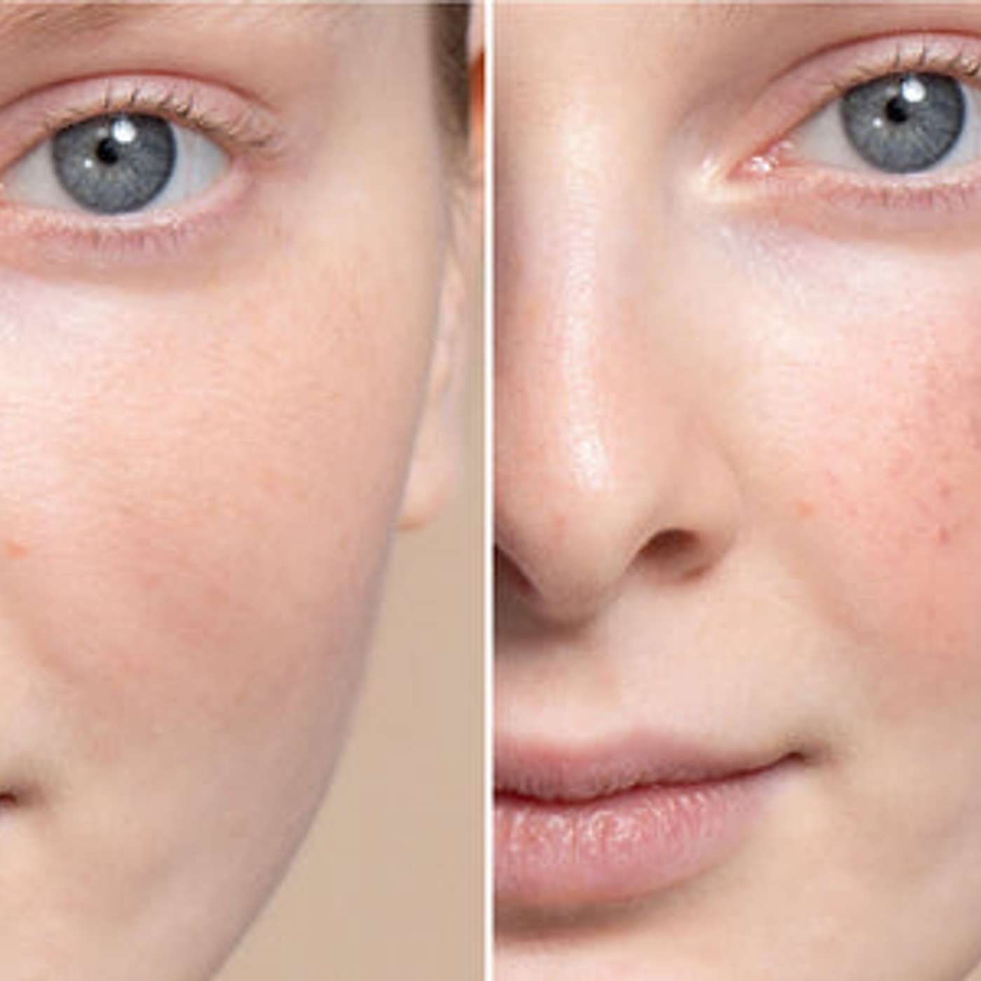 IPL vs. LED Red Light: Your Guide to Glowing Facial Skin