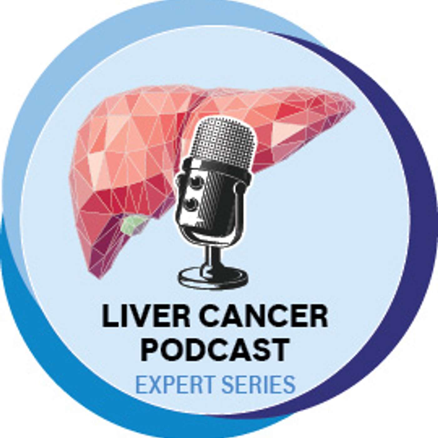Liver Cancer (HCC) Expert Series